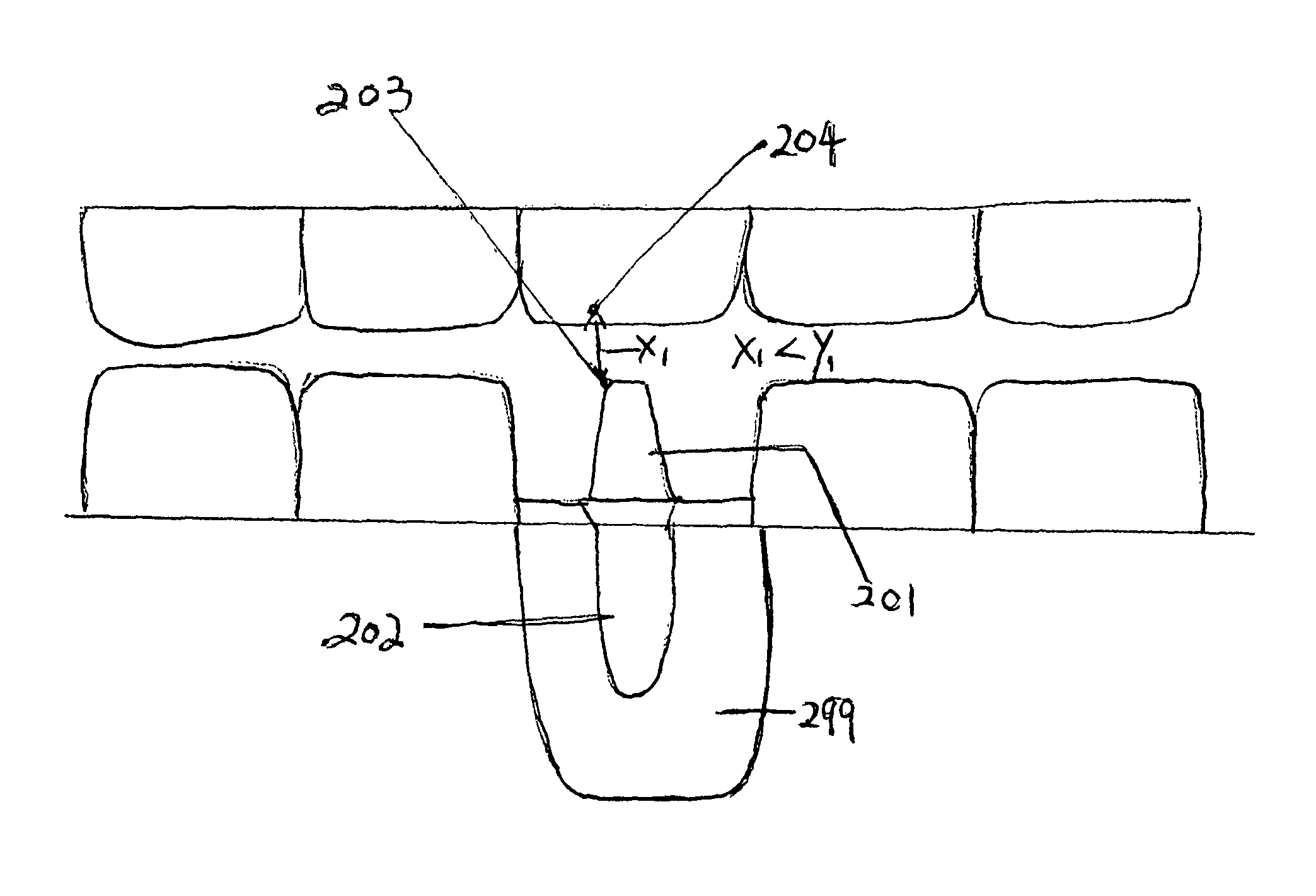 Method of dental implant restoration