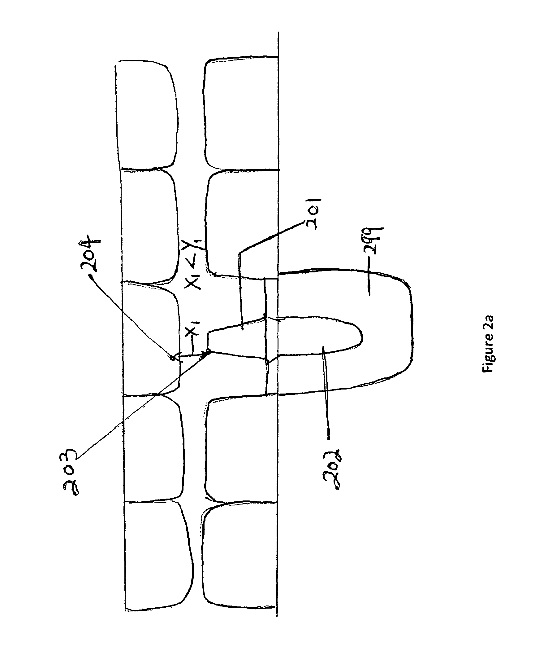 Method of dental implant restoration