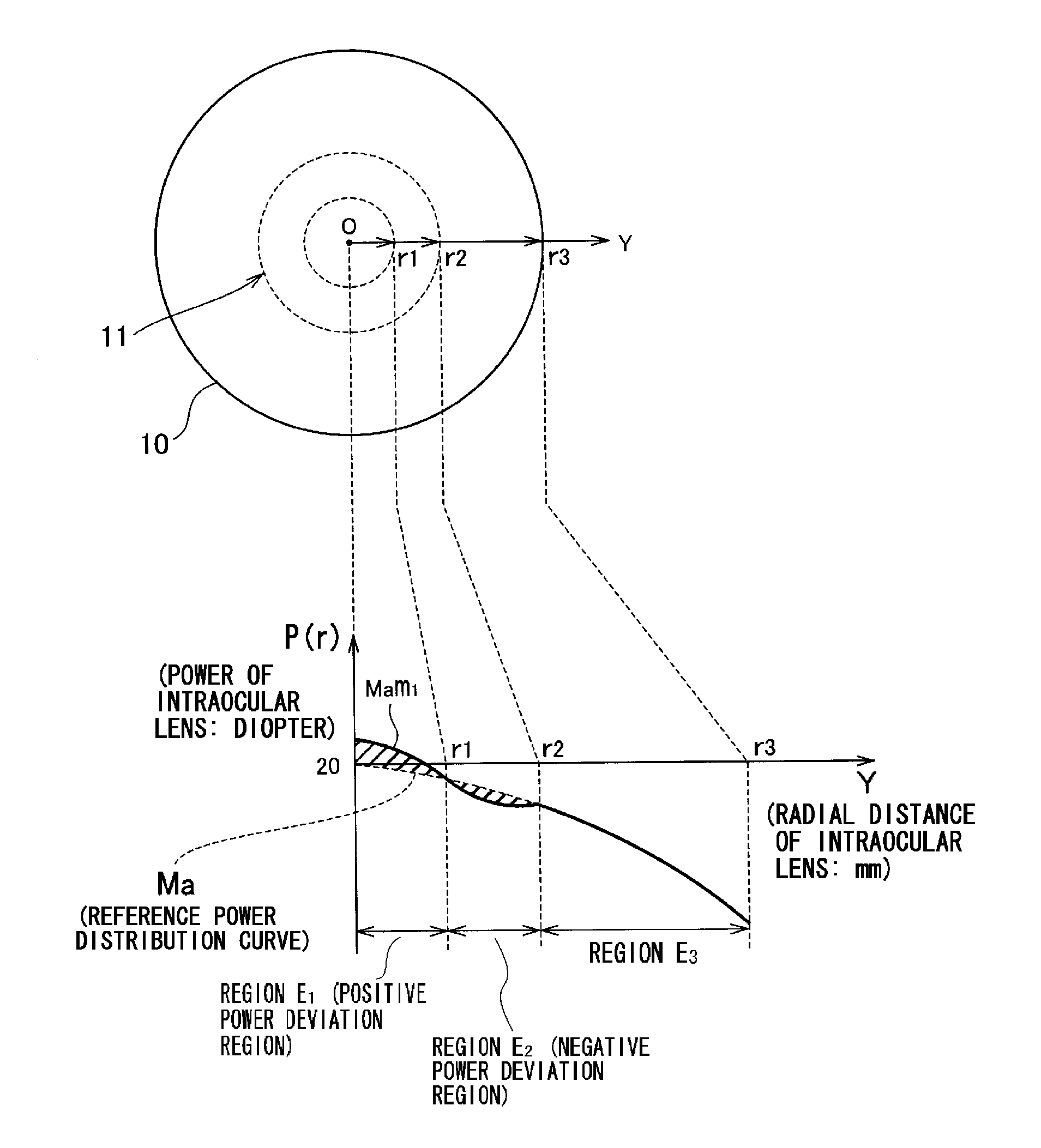 Intraocular lens