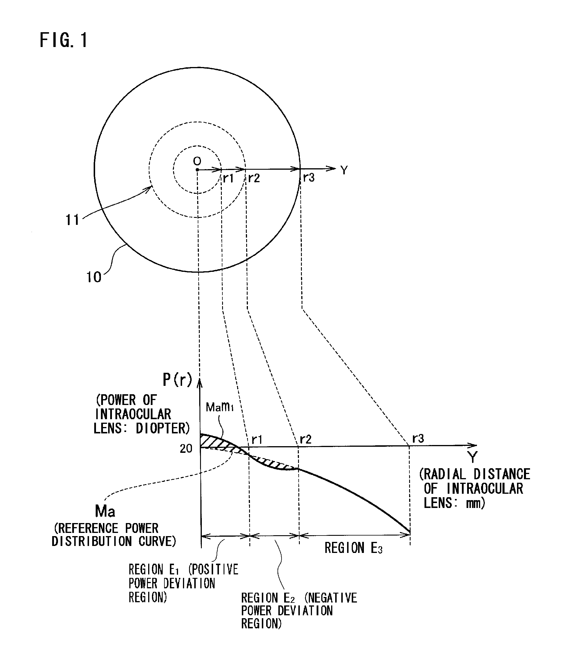 Intraocular lens