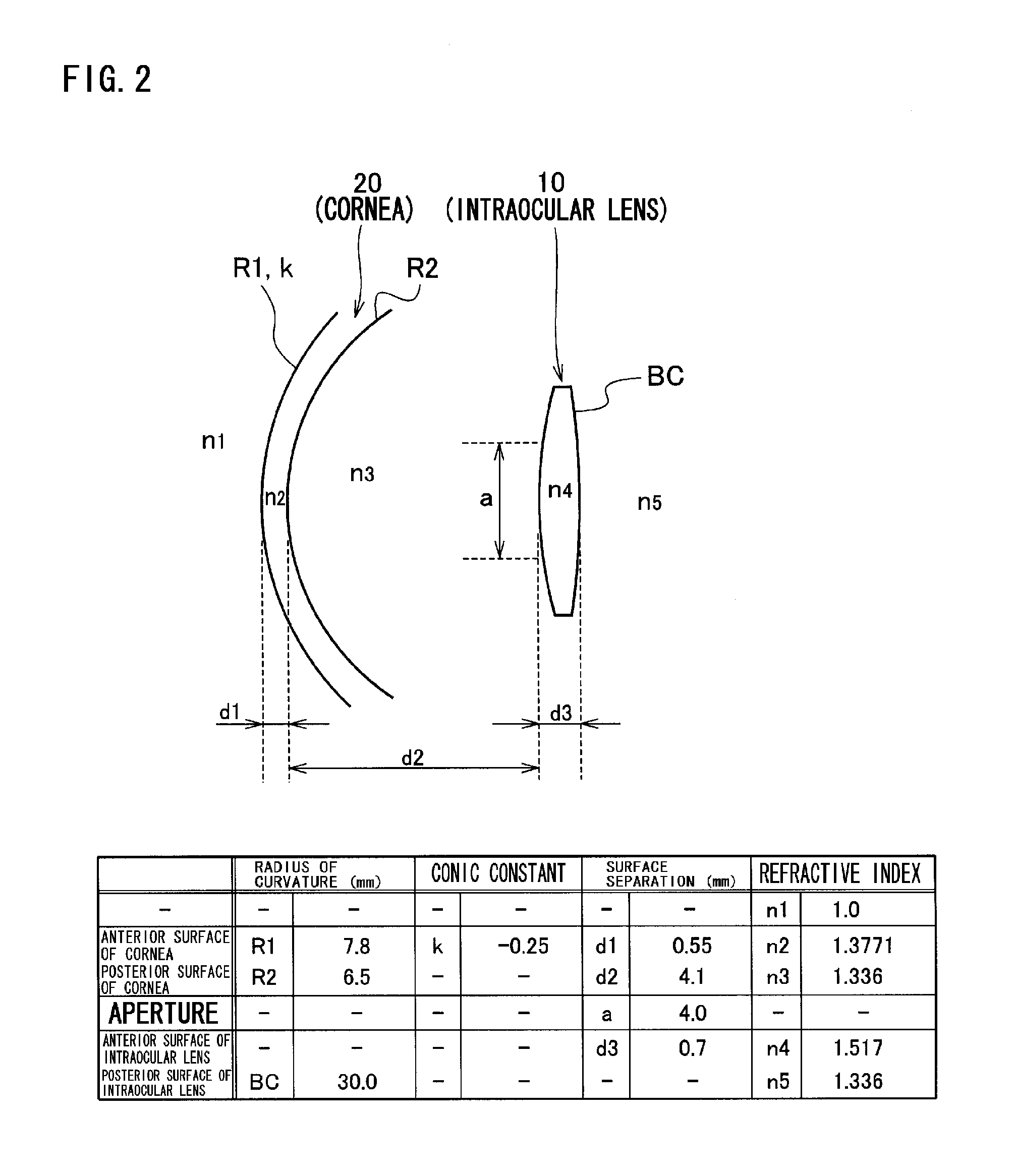 Intraocular lens