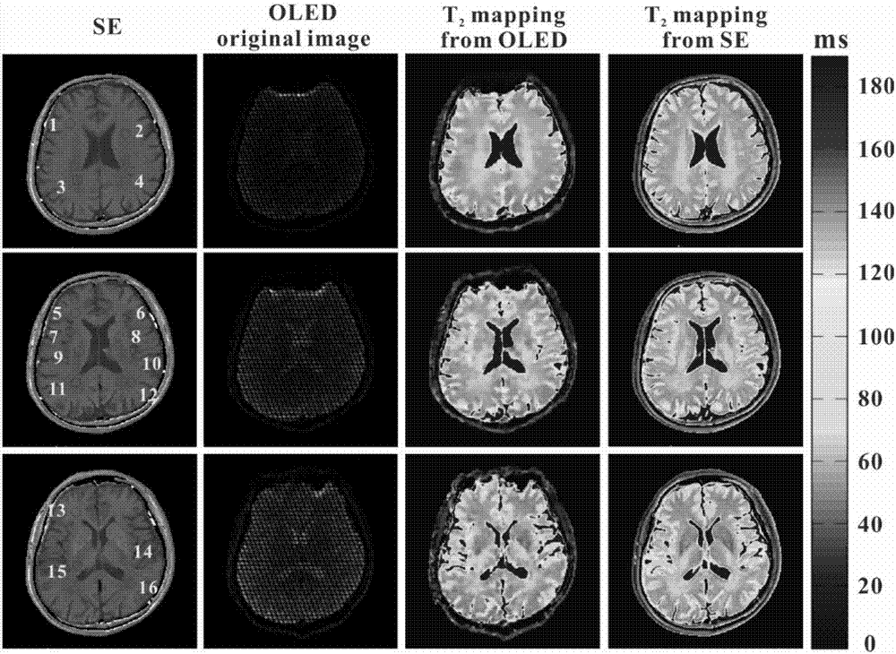 Single-scanning magnetic resonance quantitative T2 imaging reconstruction method based on residual network