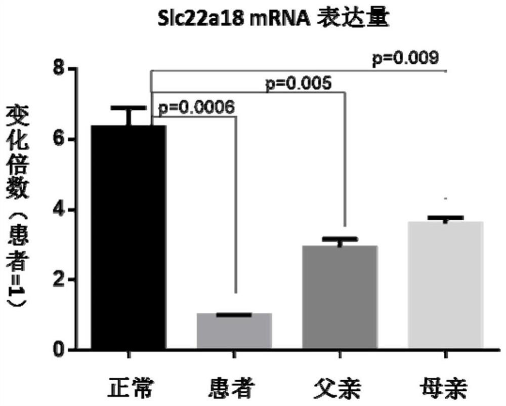 Gene slc22a18 affecting fat metabolism and growth and development in children