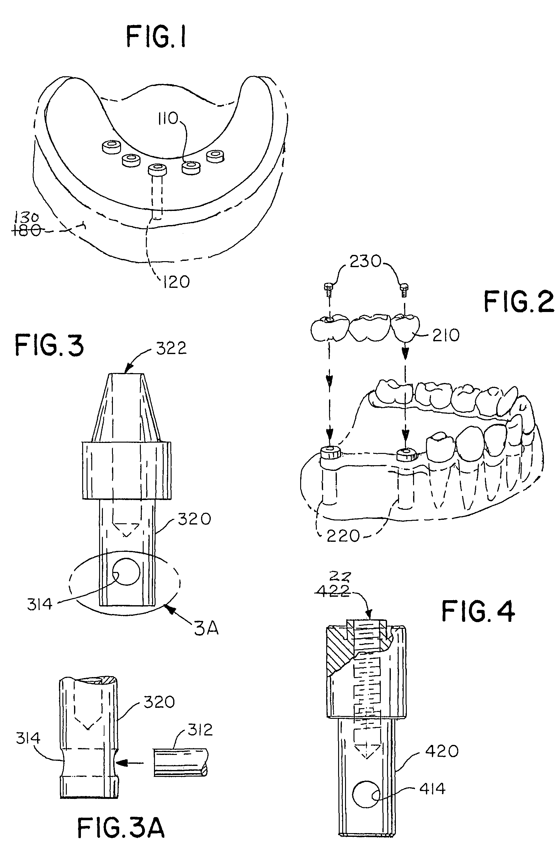 Accurate analogs for prostheses using computer generated anatomical models