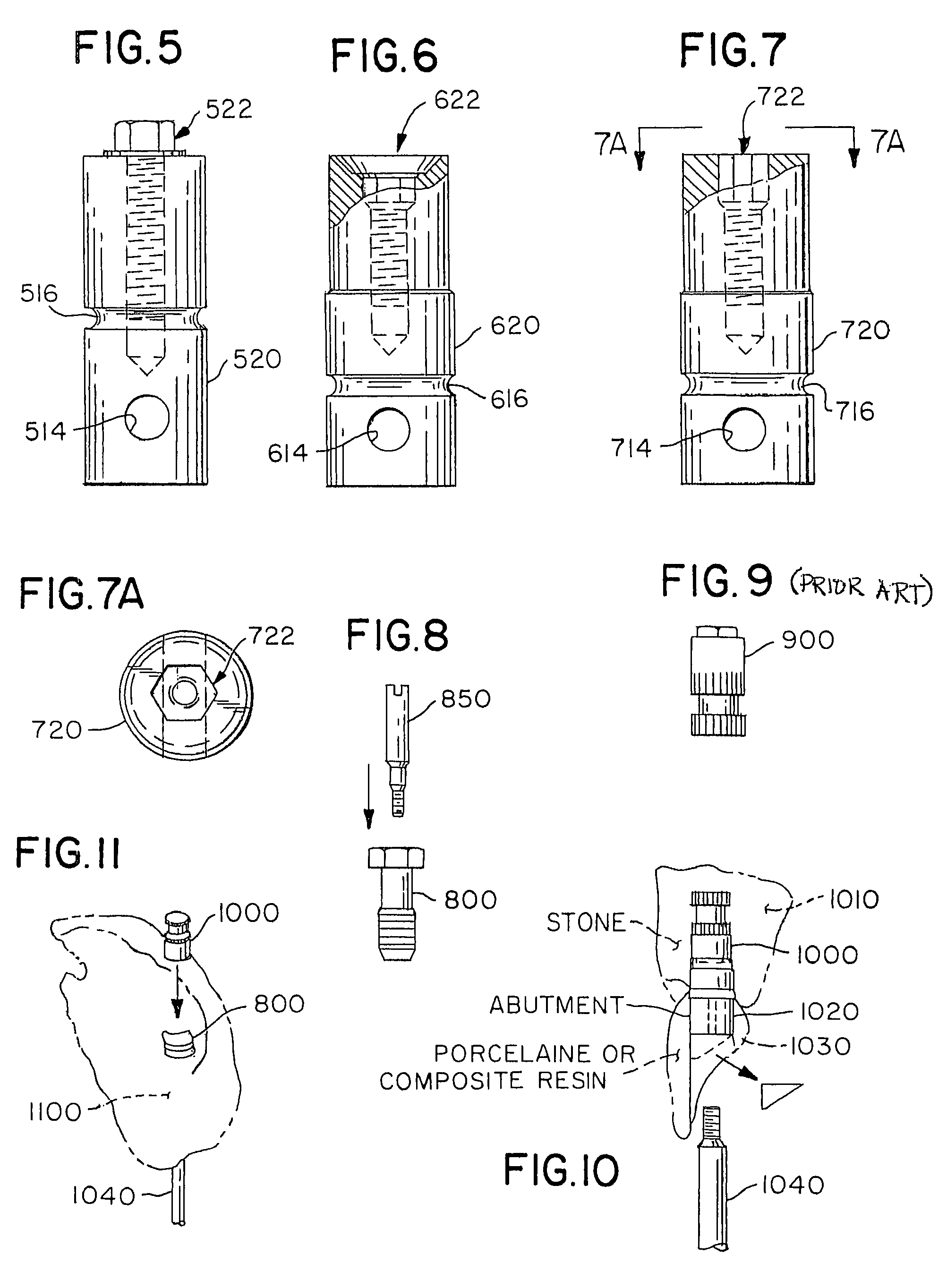 Accurate analogs for prostheses using computer generated anatomical models