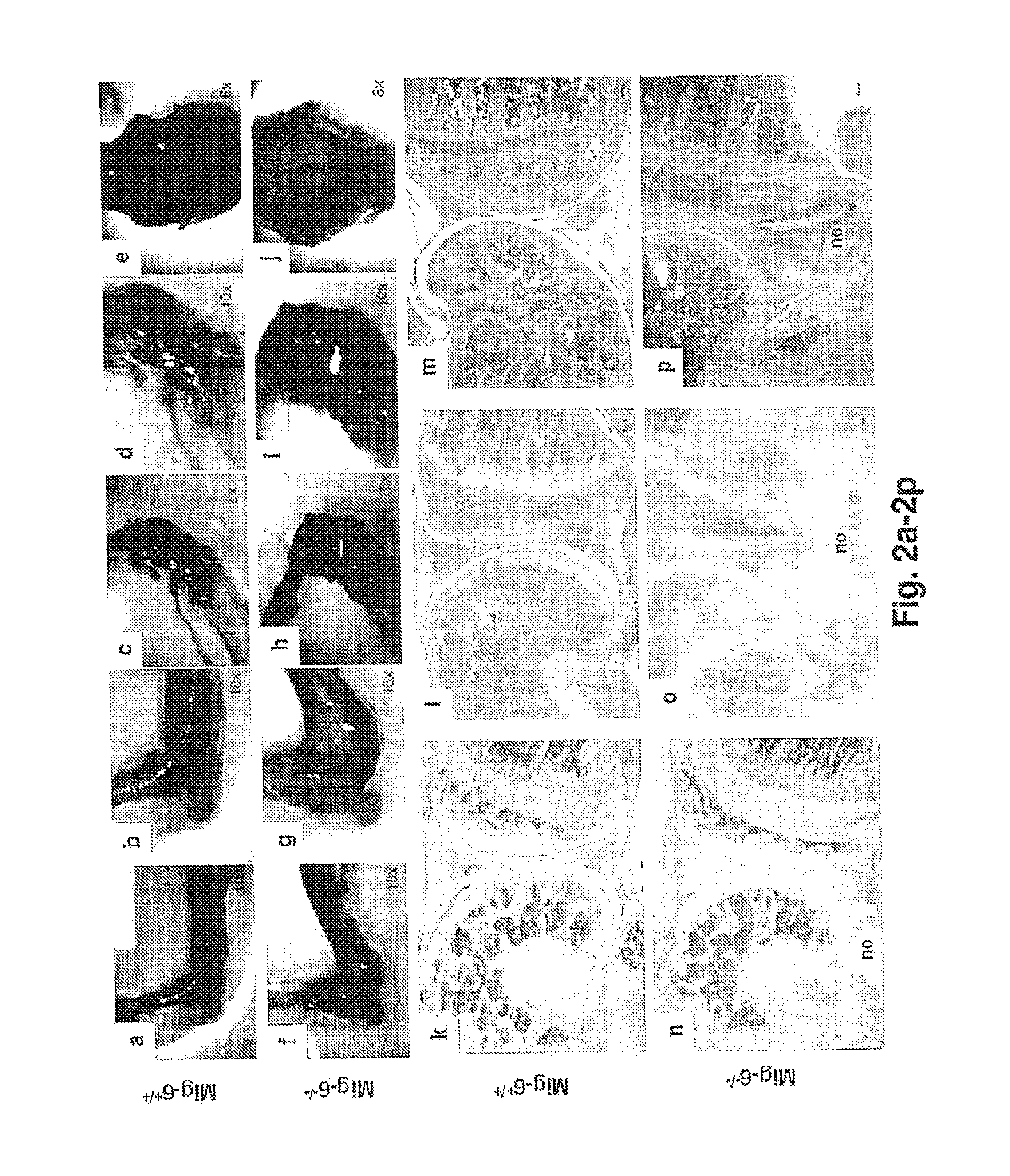 Mig-6 Knockout Mice and Elucidation of Association of Mig-6 With Early Onset Degenerative Joint Disease and Role As A Tumor Suppressor