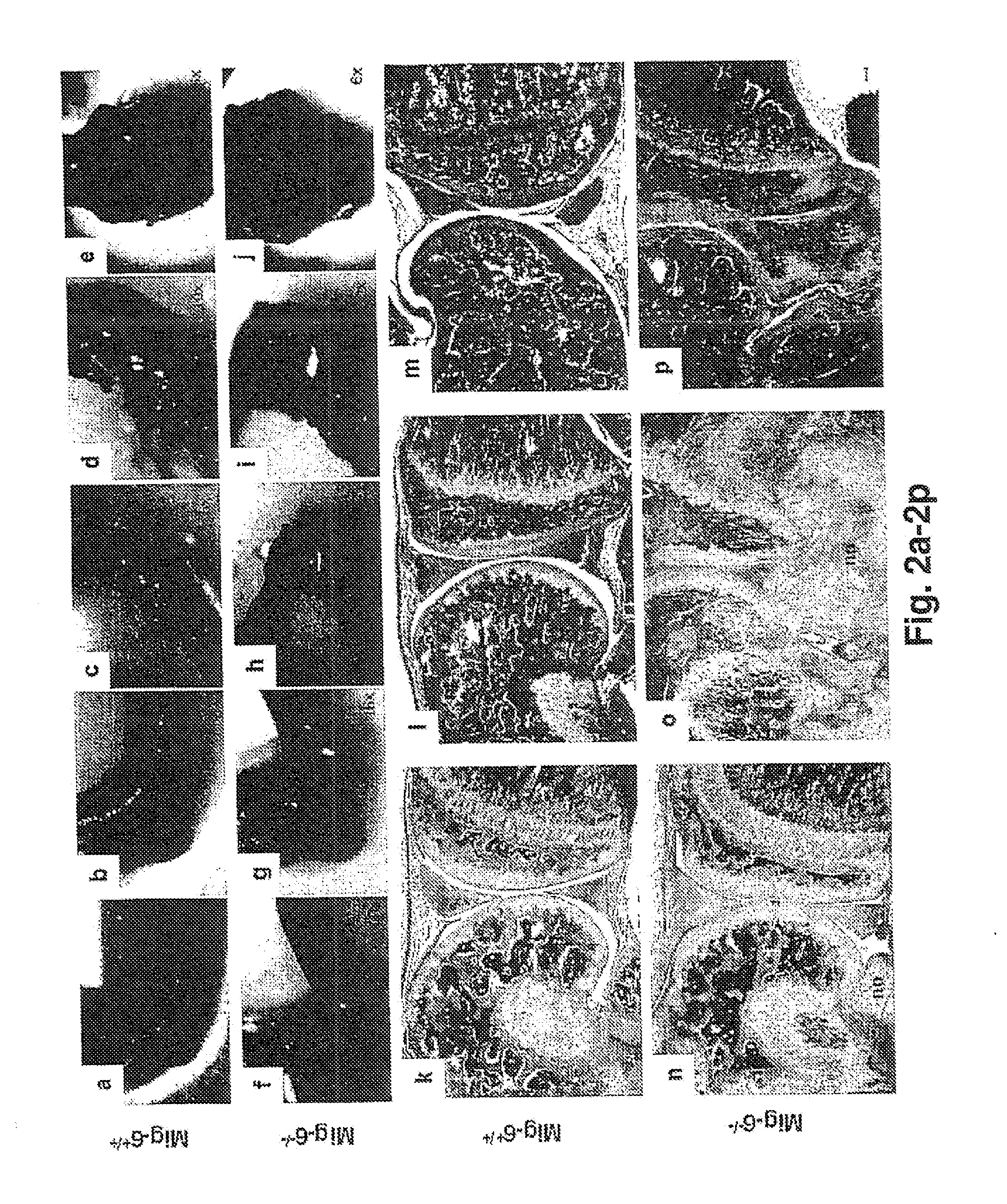 Mig-6 Knockout Mice and Elucidation of Association of Mig-6 With Early Onset Degenerative Joint Disease and Role As A Tumor Suppressor