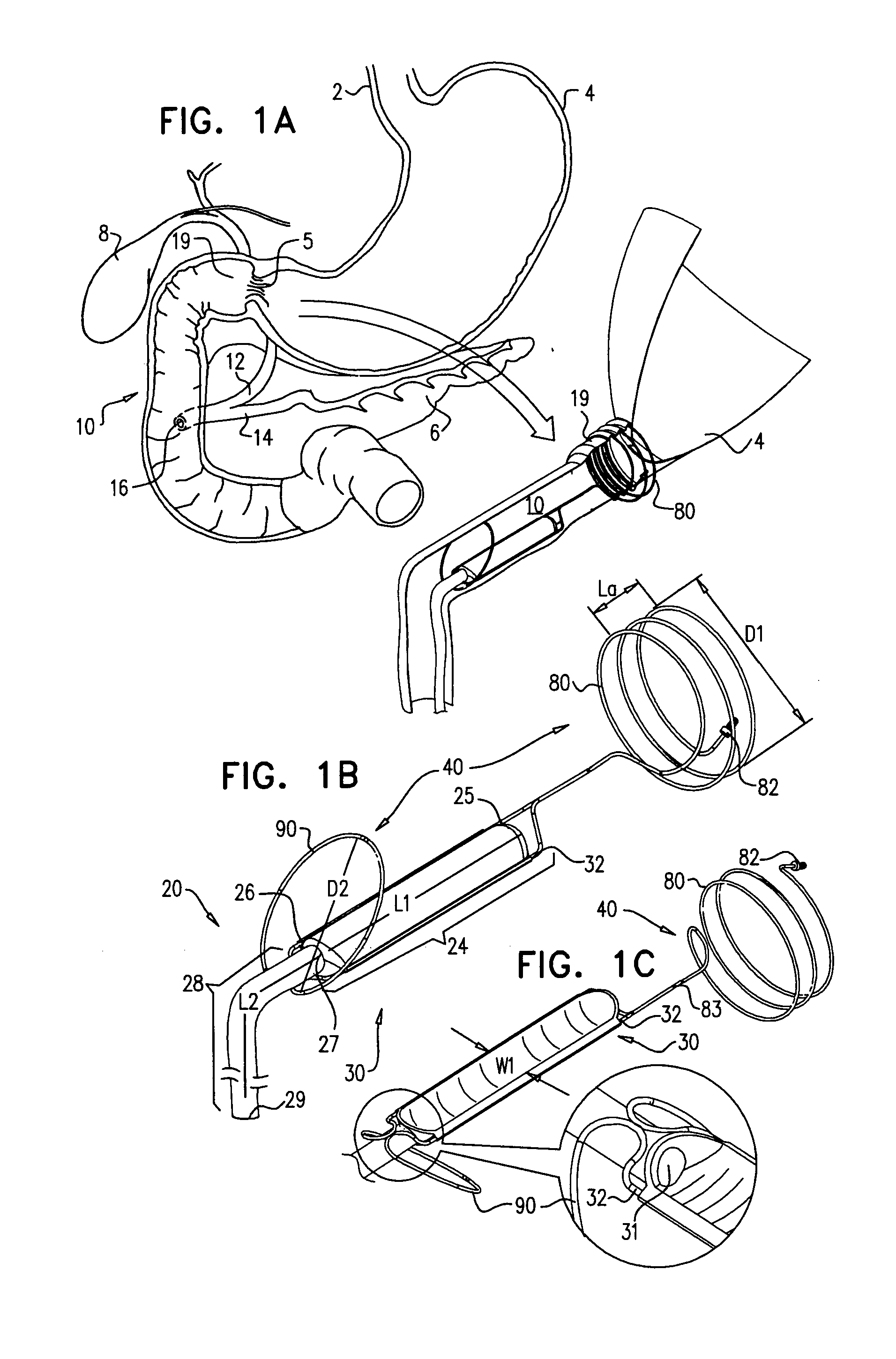 Pancreaticobiliary diversion device