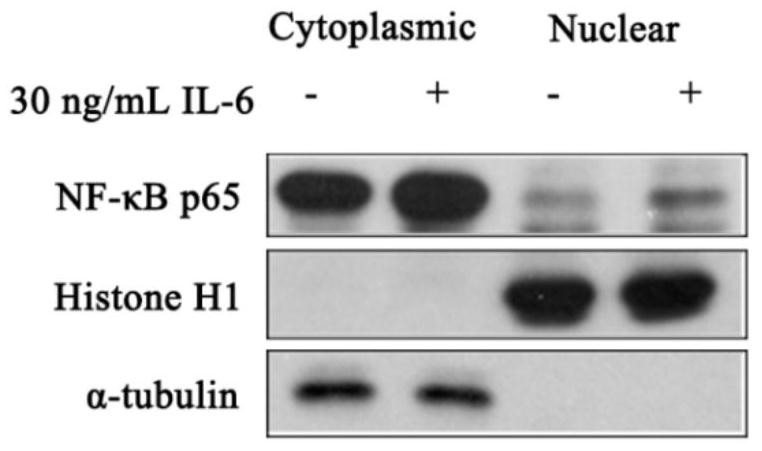 Application of nf-κb p65/HMGCS2 regulatory pathway in preparation of drugs regulating ketone body synthesis