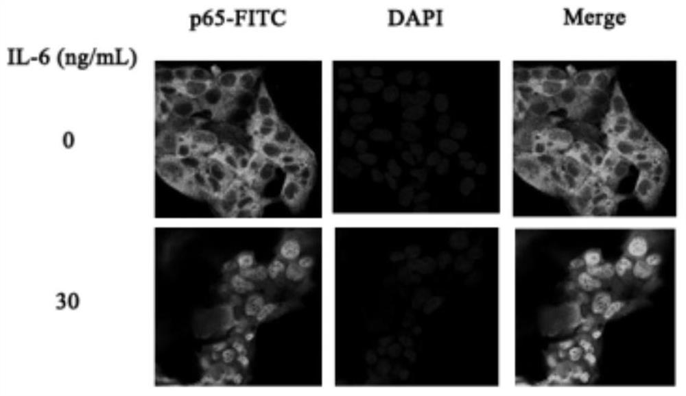 Application of nf-κb p65/HMGCS2 regulatory pathway in preparation of drugs regulating ketone body synthesis