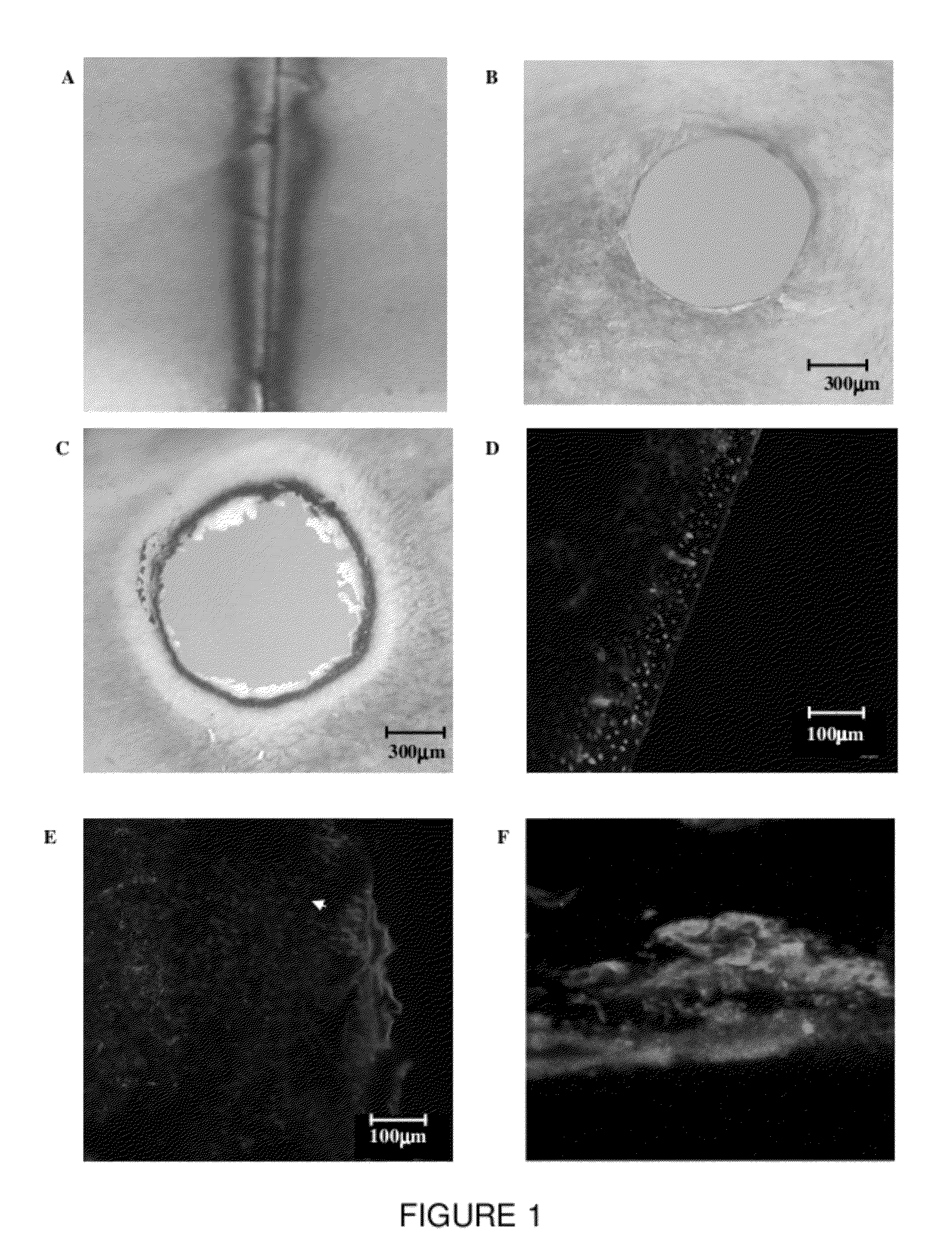 Laser selective cutting by impulsive heat deposition in the ir wavelength range for direct-drive ablation