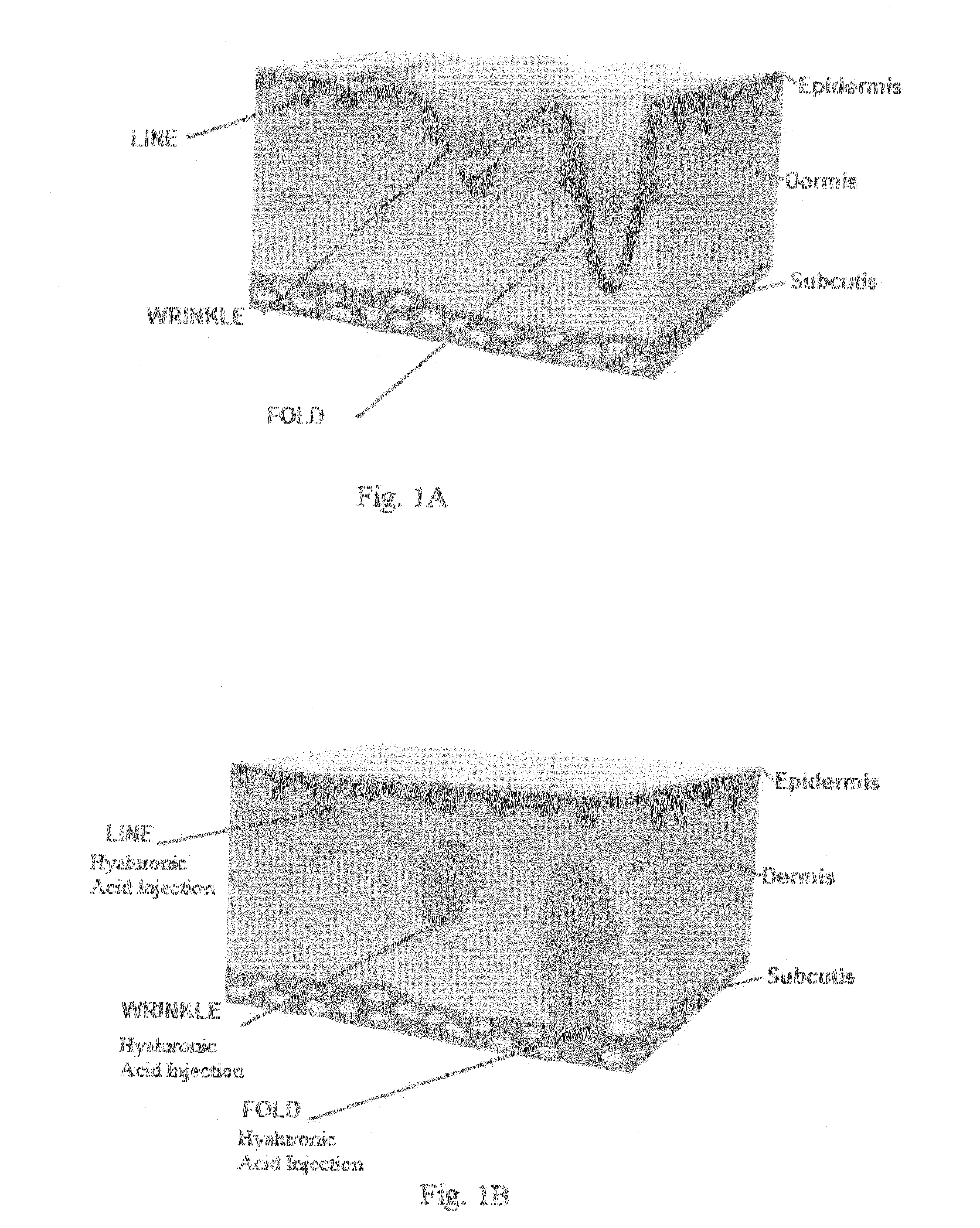 Swellable hyaluronic acid particles