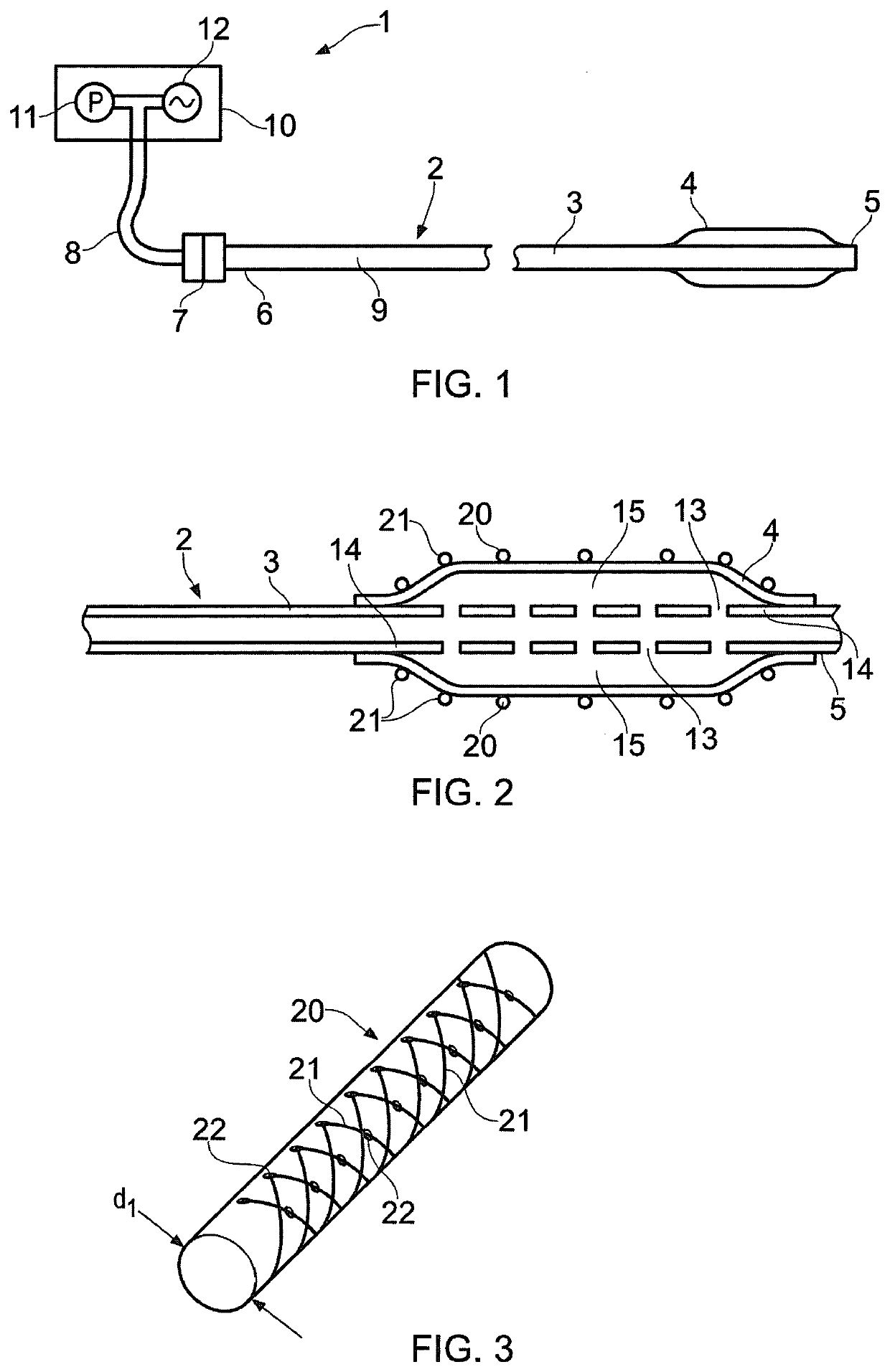 Angioplasty of calcified arteries