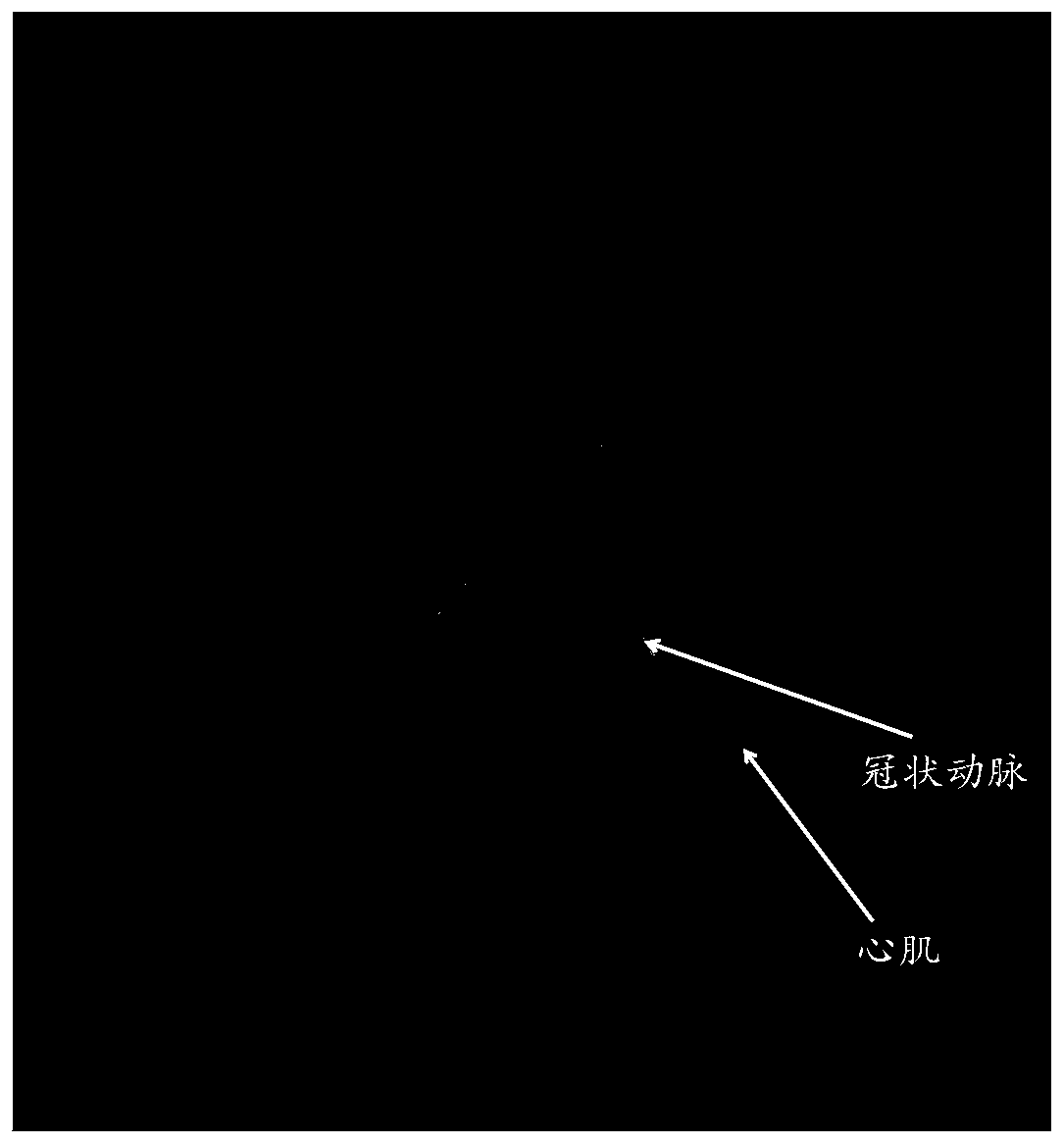 Heart data processing apparatus and method, and computer readable storage medium