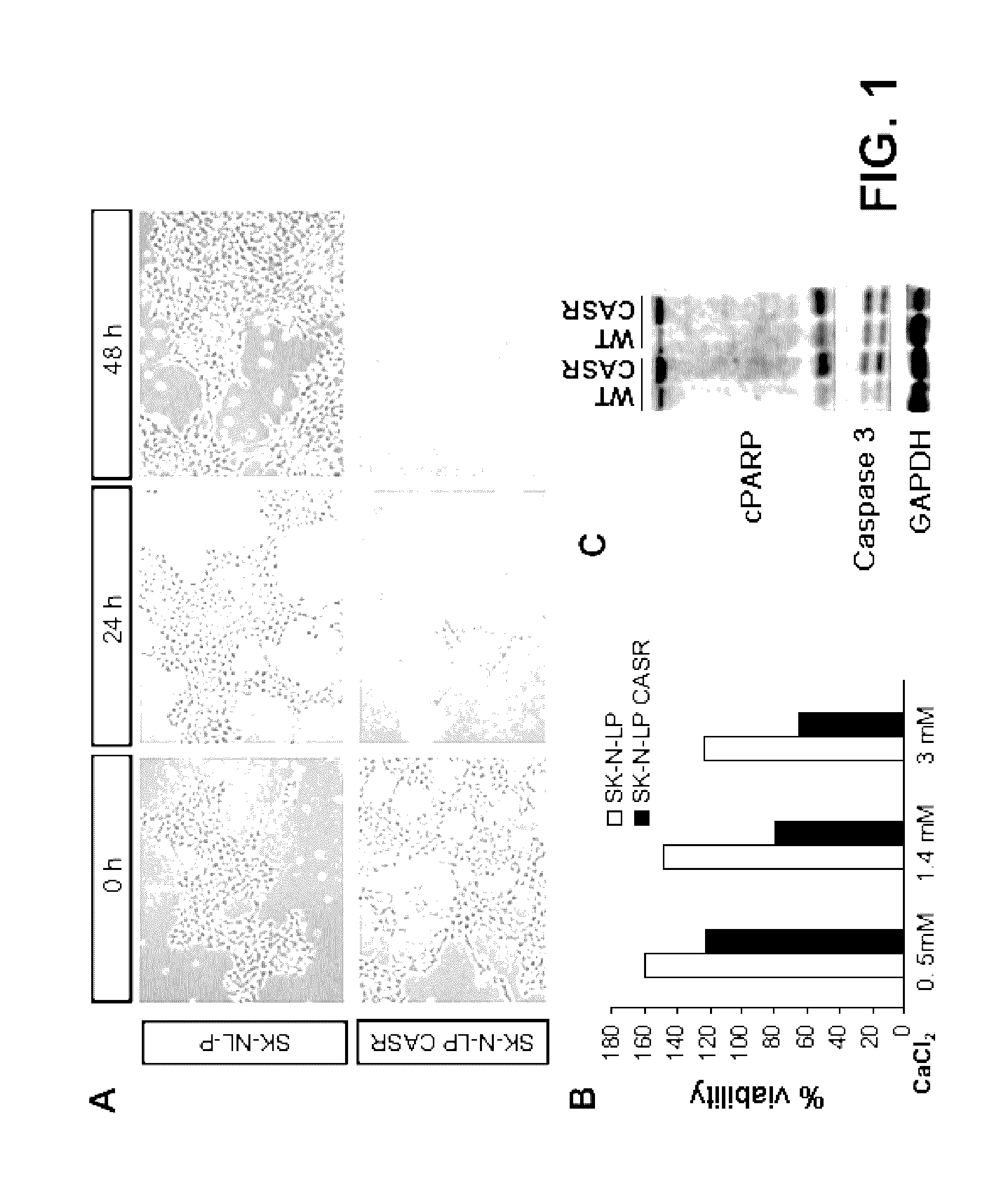 Cinacalcet and neuroblastic tumours