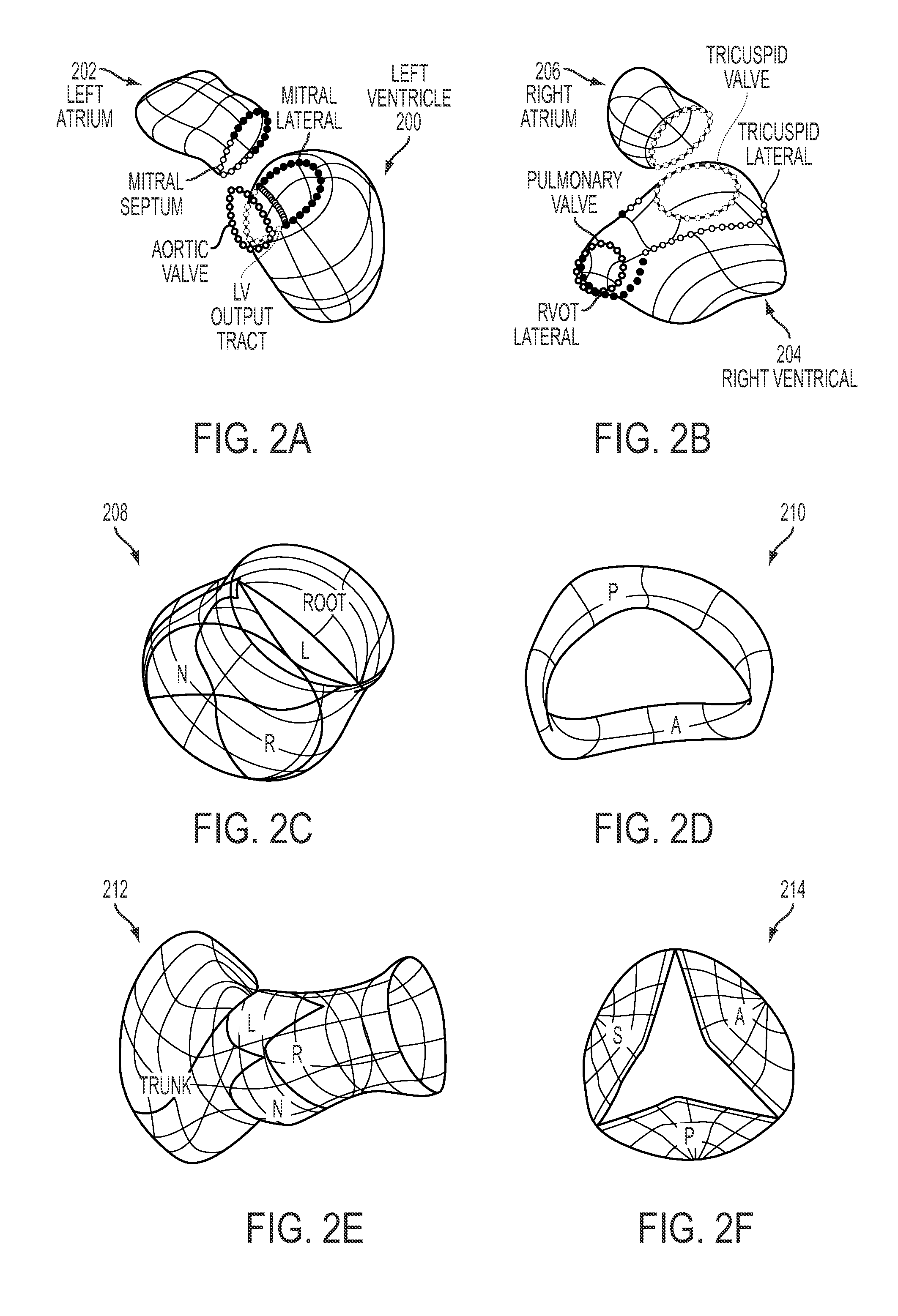 Method and System for Comprehensive Patient-Specific Modeling of the Heart