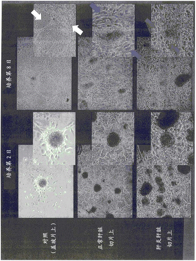 Method for inducing differentiation of induced pluripotent stem cells and method for selecting induced pluripotent stem cells