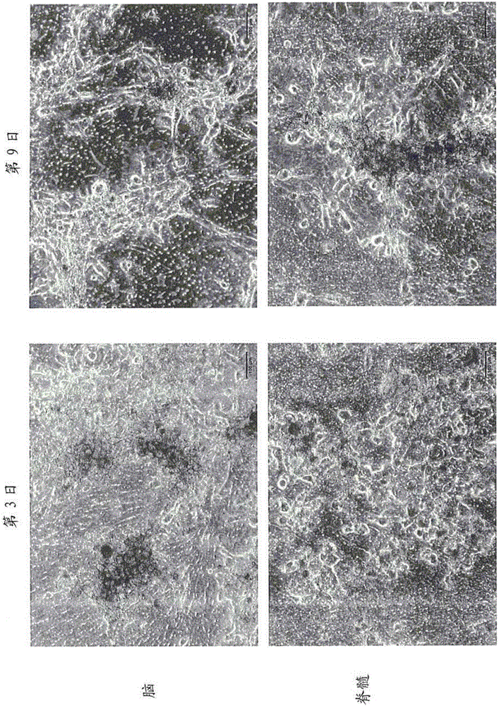 Method for inducing differentiation of induced pluripotent stem cells and method for selecting induced pluripotent stem cells