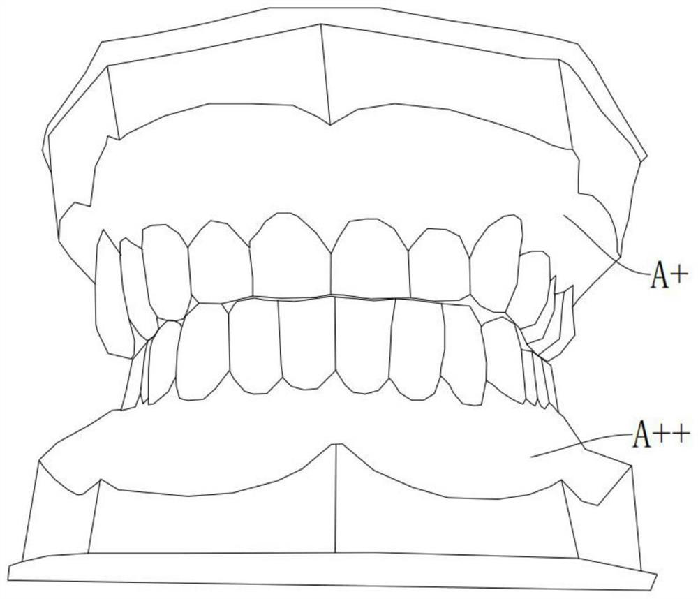 Complete removable denture resin block and digital complete removable denture manufacturing method