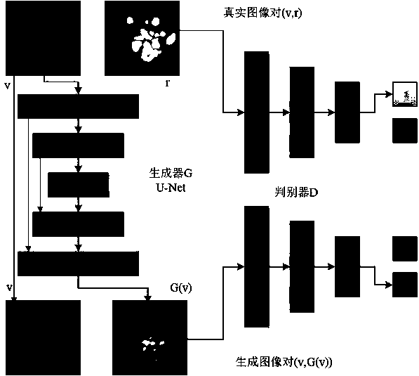 Fundus image focus area labeling method based on deep learning