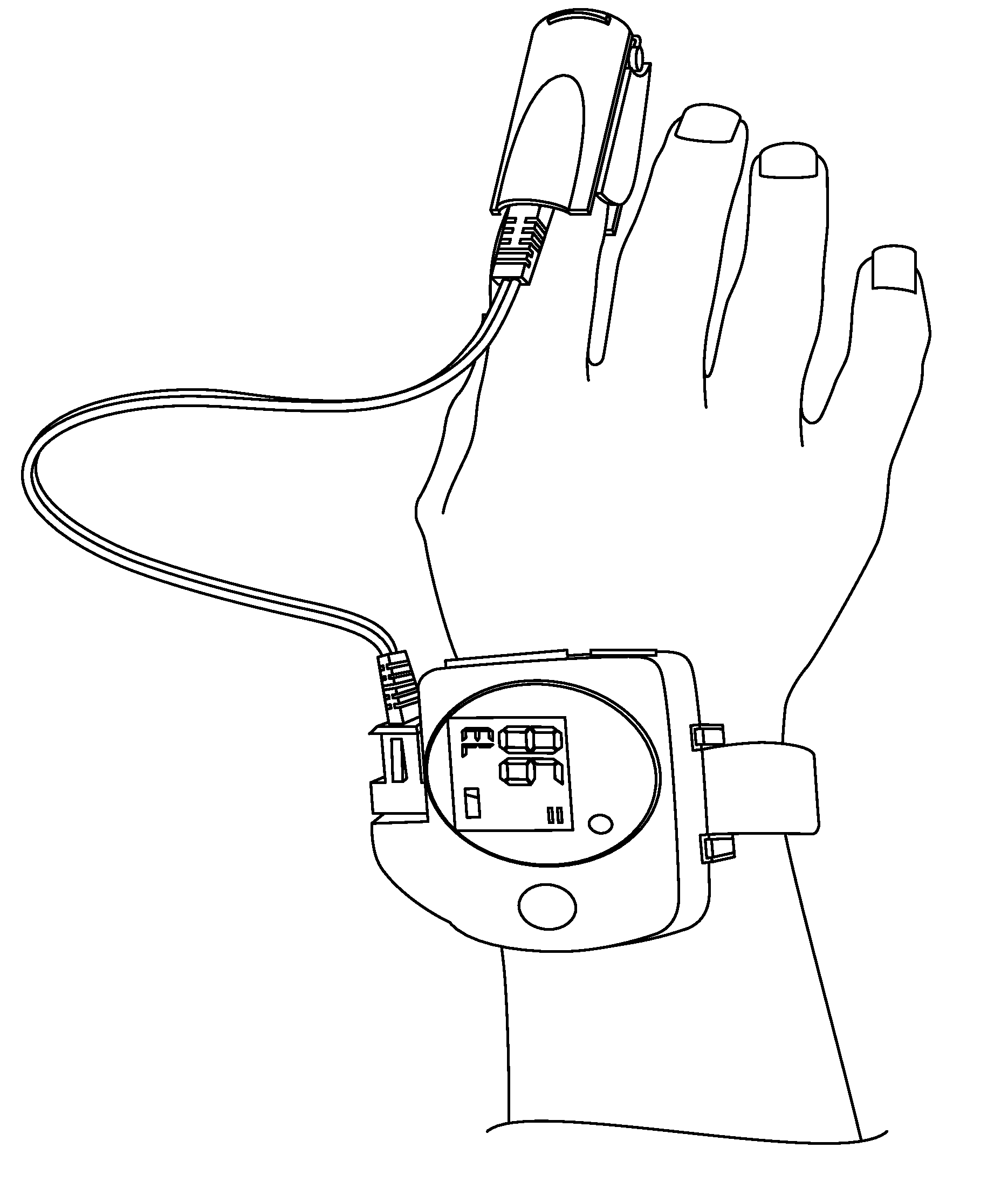 Simultaneous ambulatory pulse oximetry and ph monitoring for the diagnosis of gerd-related respiratory disease