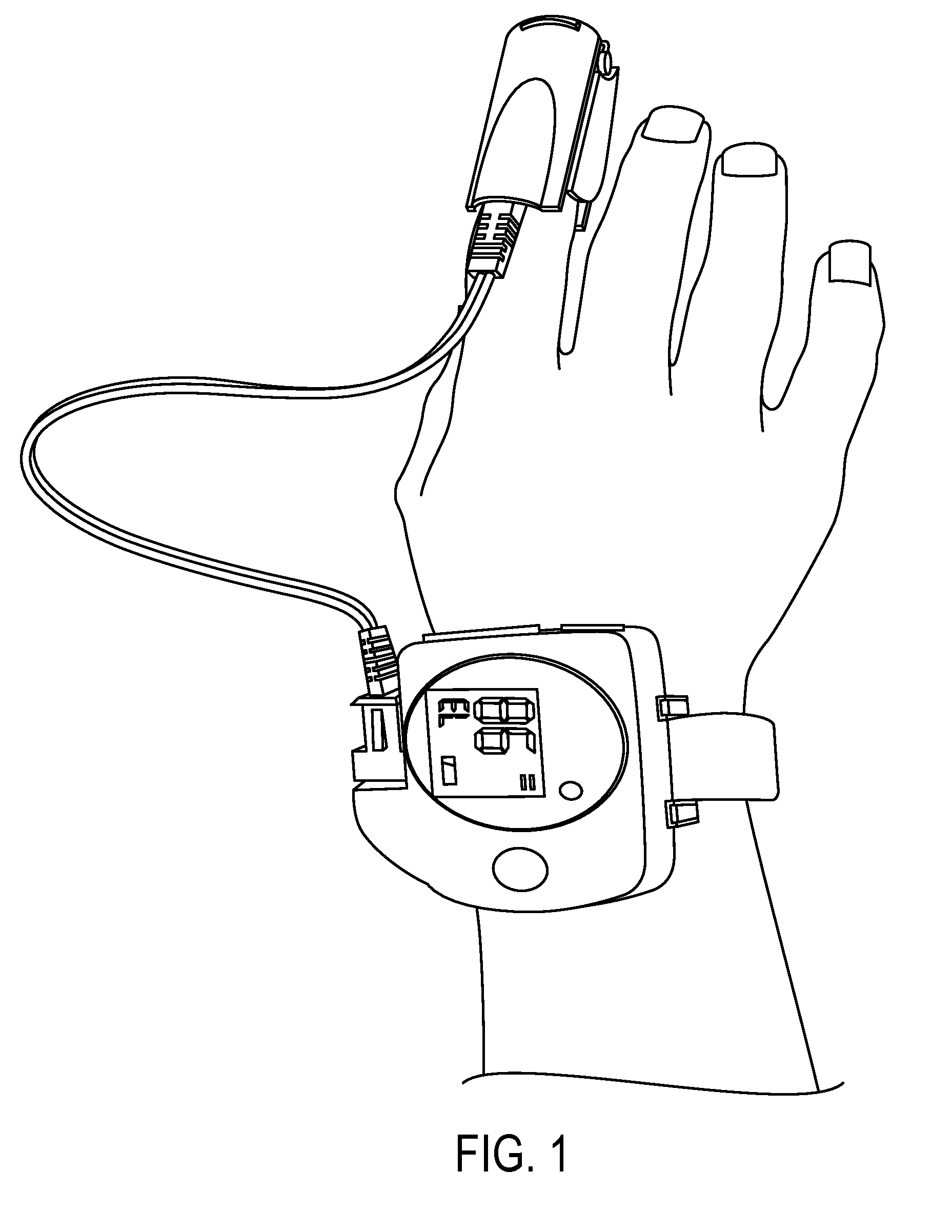 Simultaneous ambulatory pulse oximetry and ph monitoring for the diagnosis of gerd-related respiratory disease