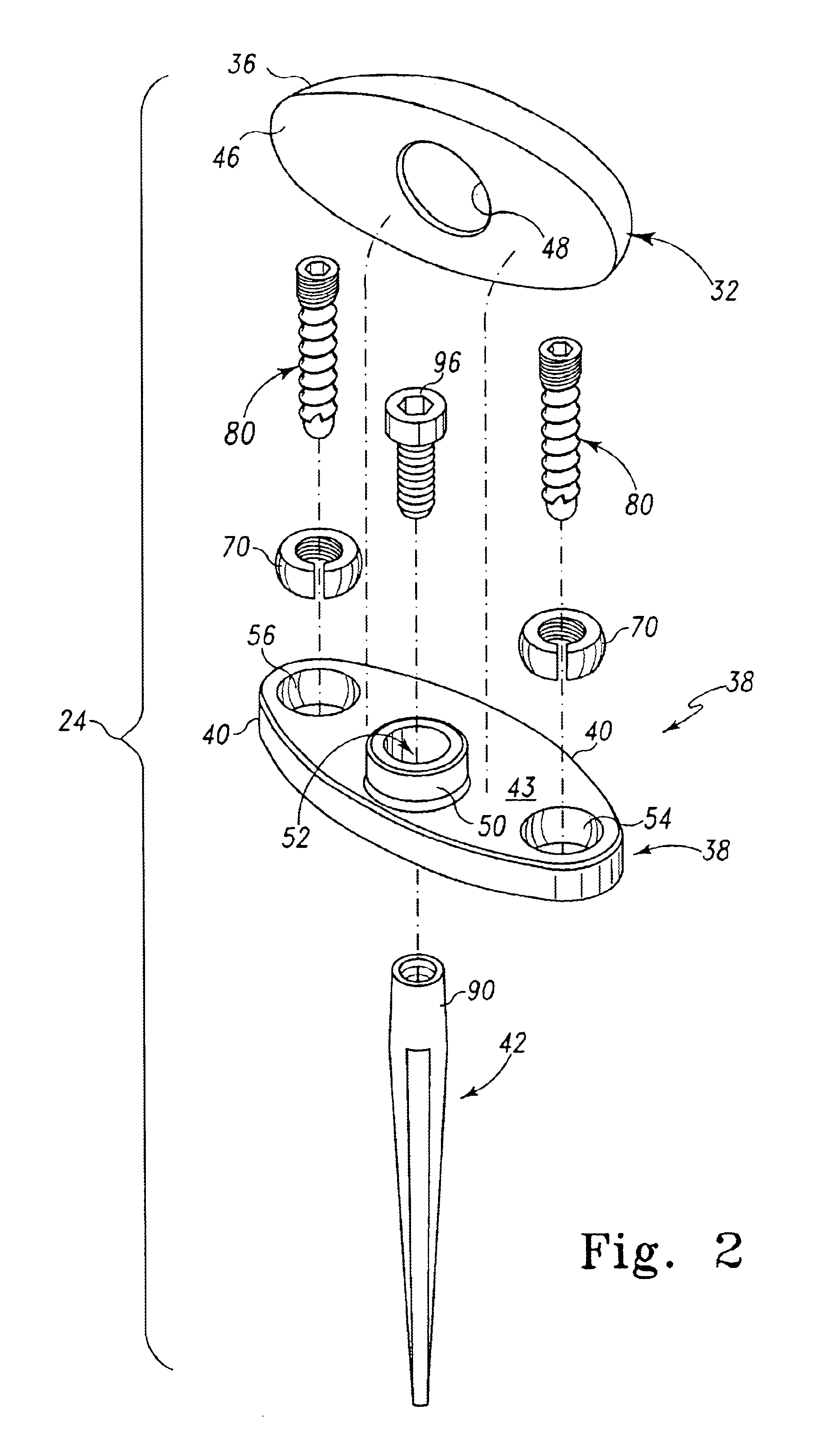 Distal component for wrist prosthesis