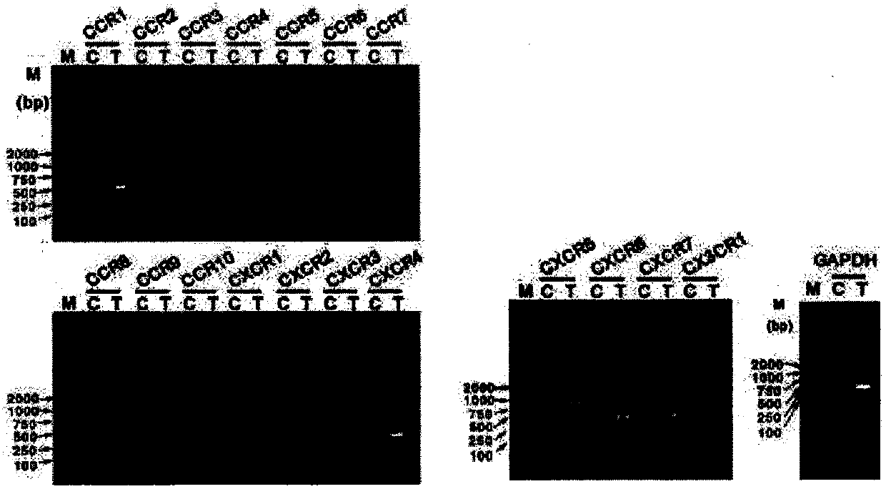 Method and medicament for inhibiting generation of neonatal lymphatic vessel