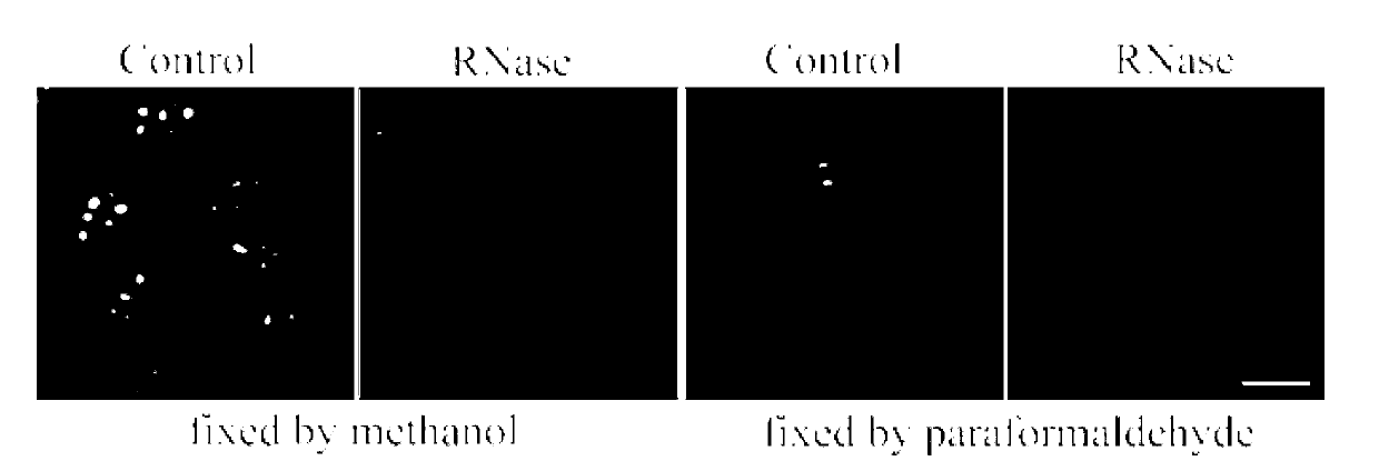 Pyrrole pyridine salt fluorescent probe used for RNA (ribonucleic acid) and nucleolus imaging in living cell