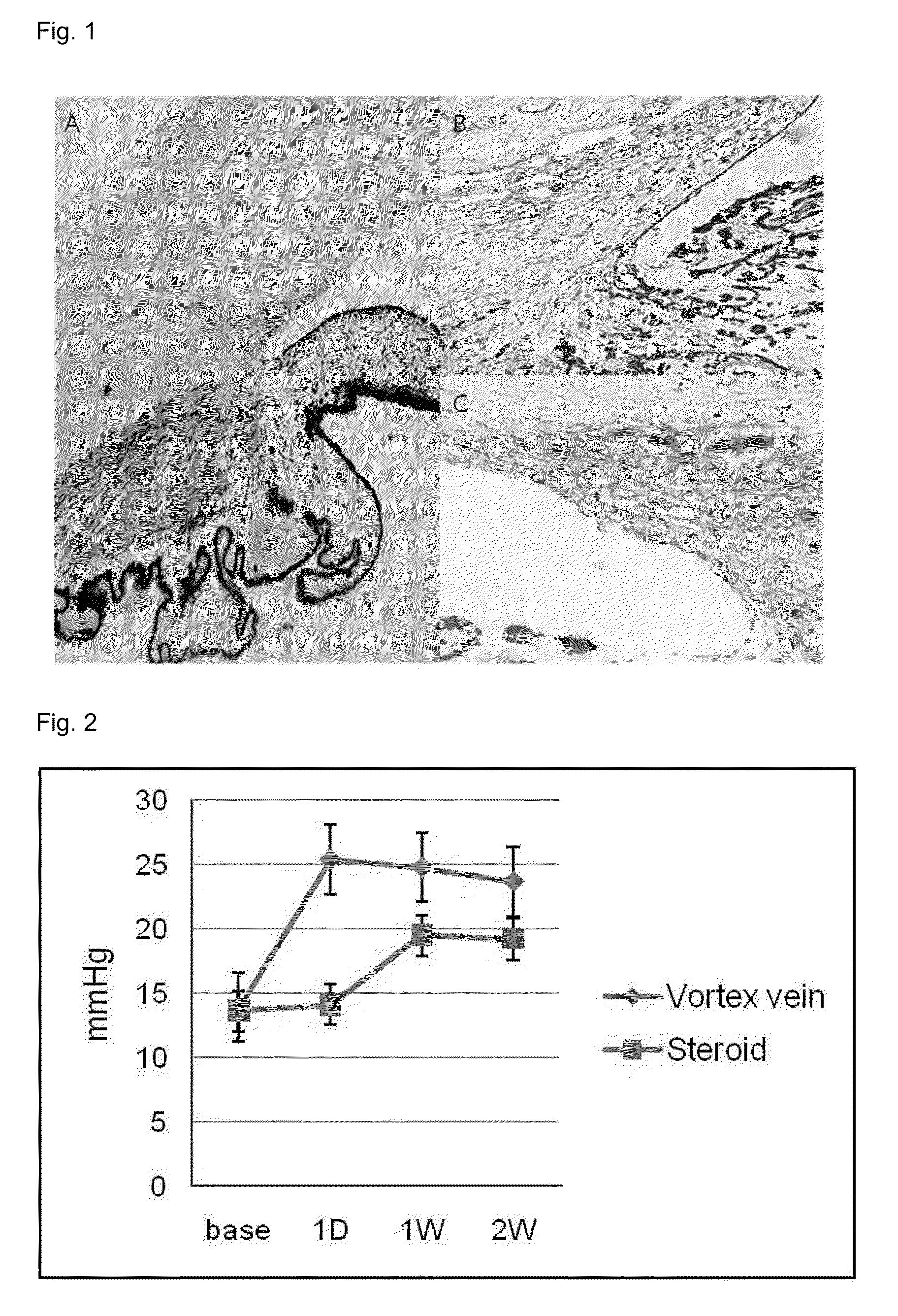 Novel use of angiogenin