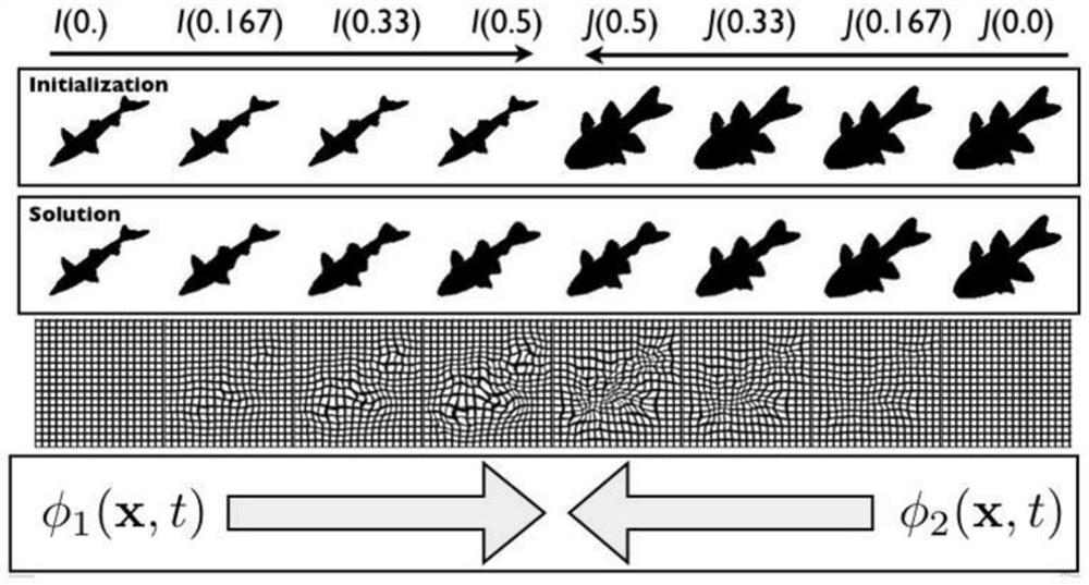 Method for auxiliary diagnosis of acute ischemic stroke based on CT flat scanning images