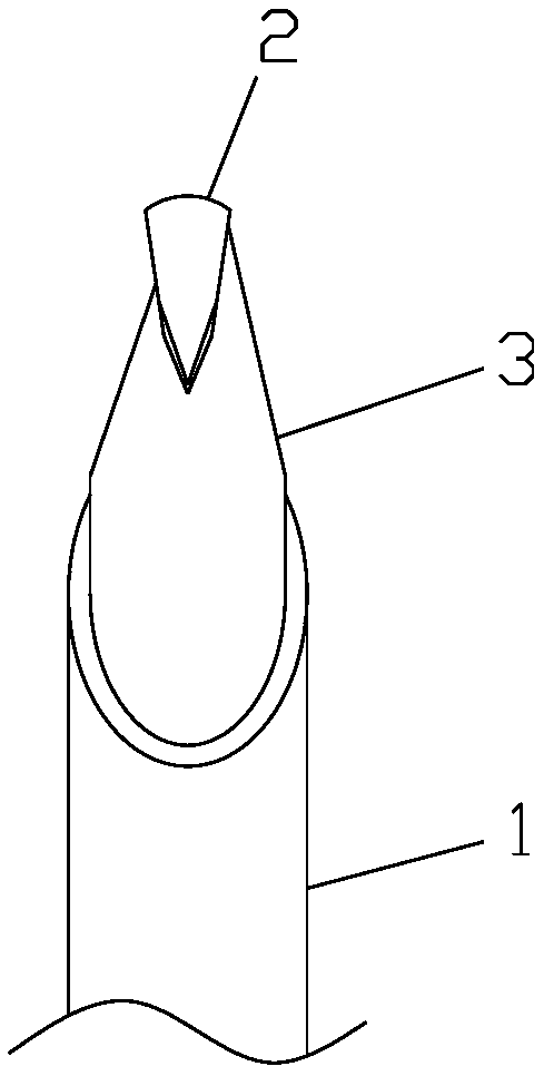 Tenosynovitis scalpel component