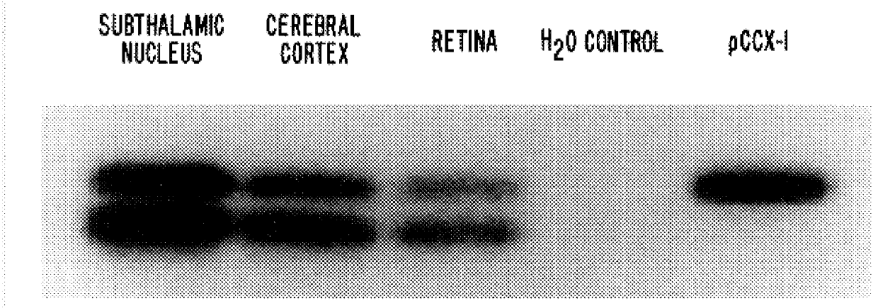 Human metabotropic glutamate receptor