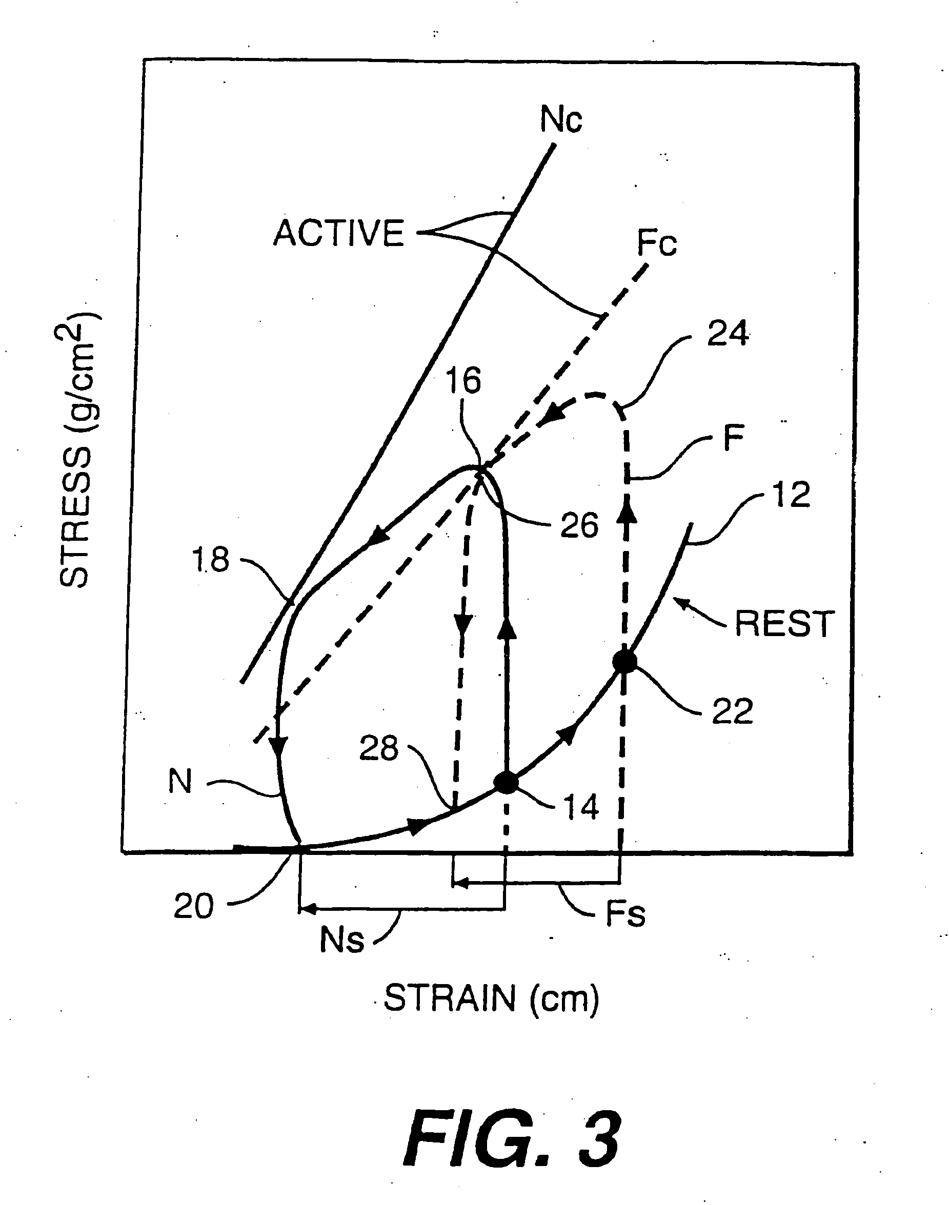 Heart wall tension reduction apparatus and method