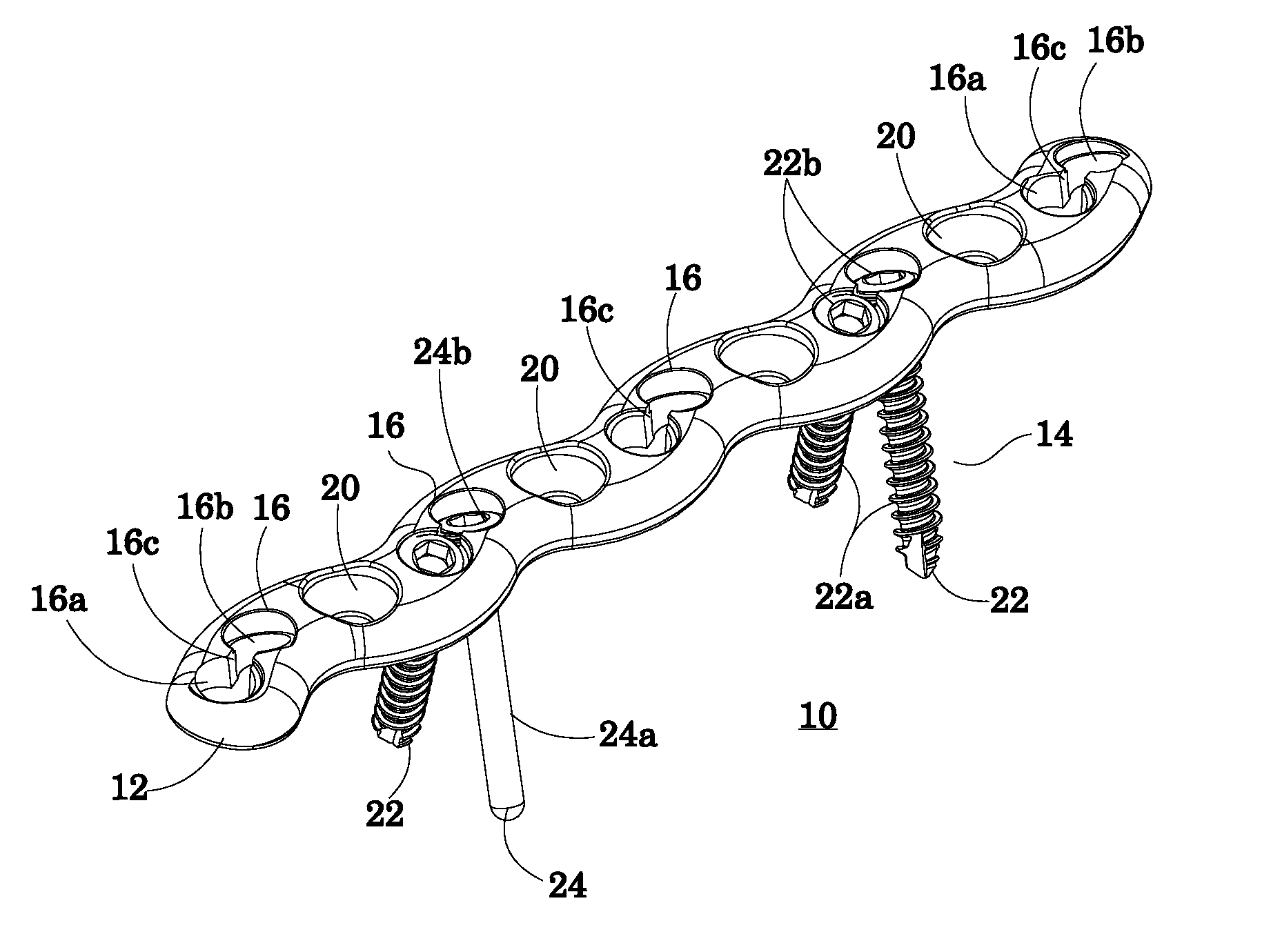 Bone fixation system and method