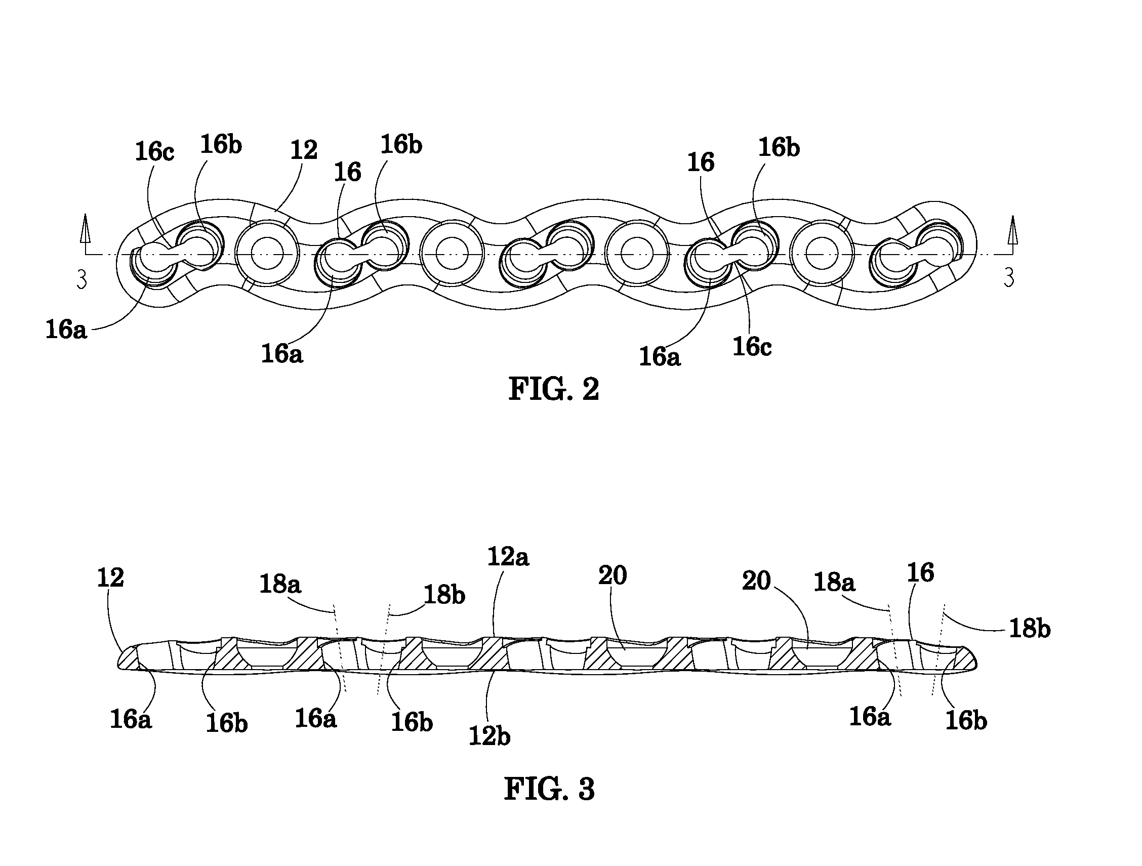 Bone fixation system and method