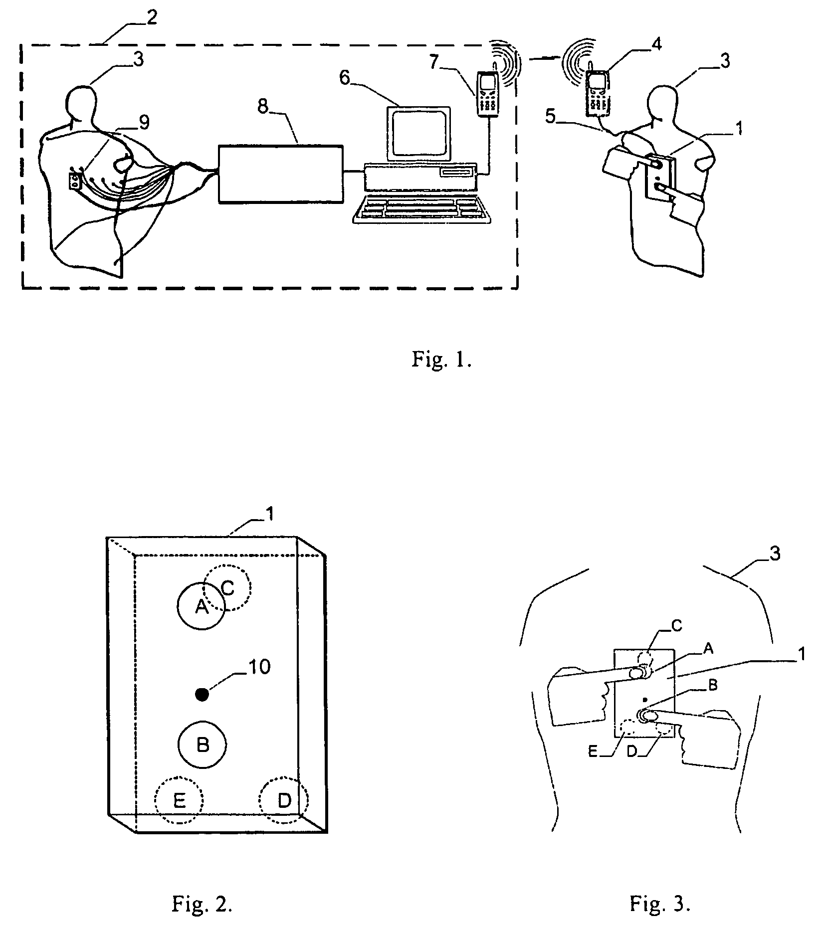 Apparatus and method for cordless recording and telecommunication transmission of three special ECG leads and their processing