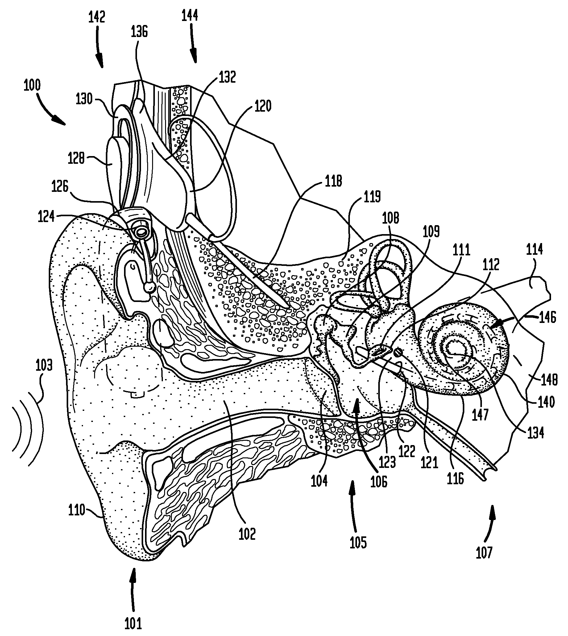 Optical neural stimulating device having a short stimulating assembly