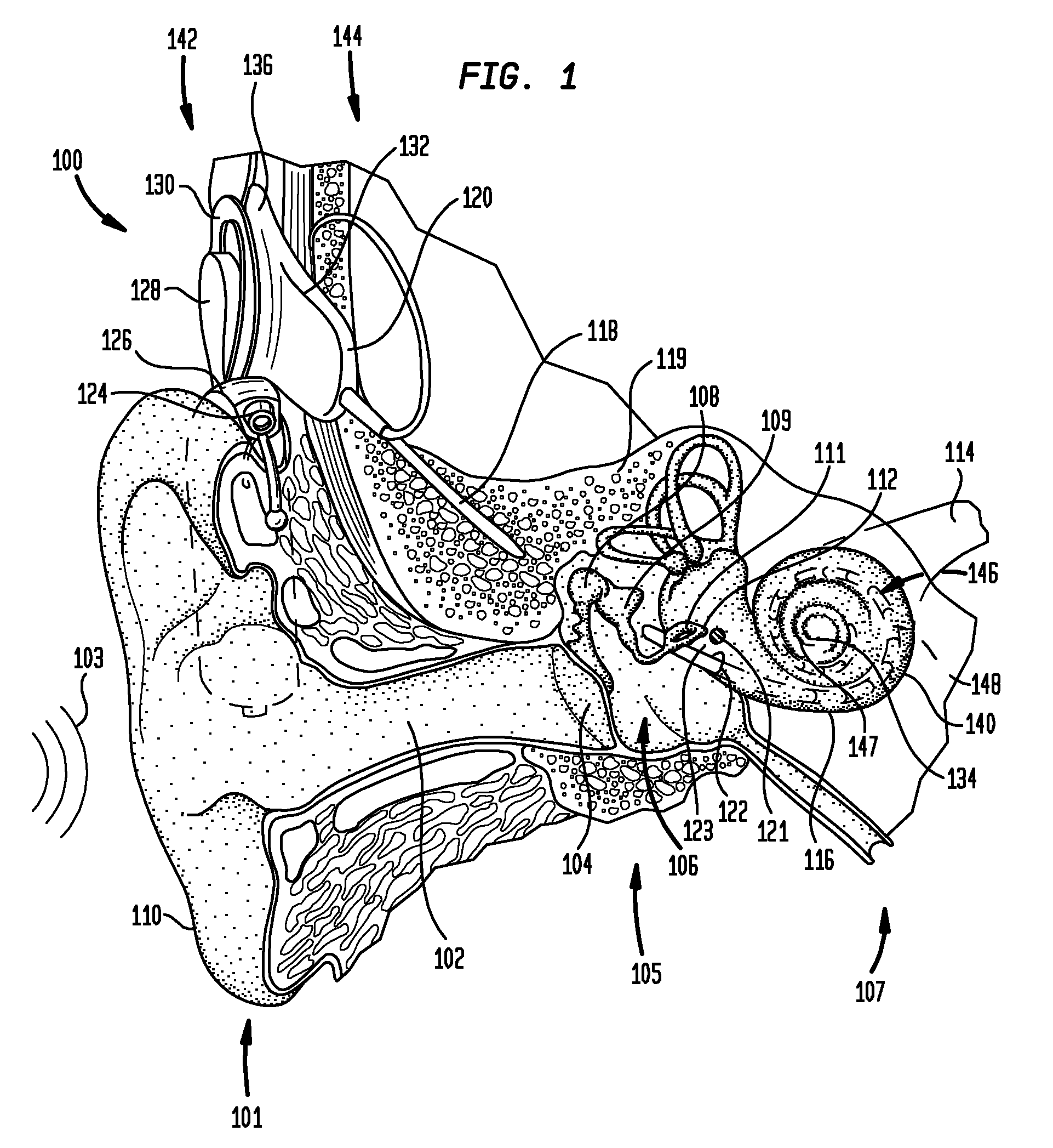 Optical neural stimulating device having a short stimulating assembly