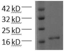 Anti-tumor polypeptide, and preparation method and application thereof