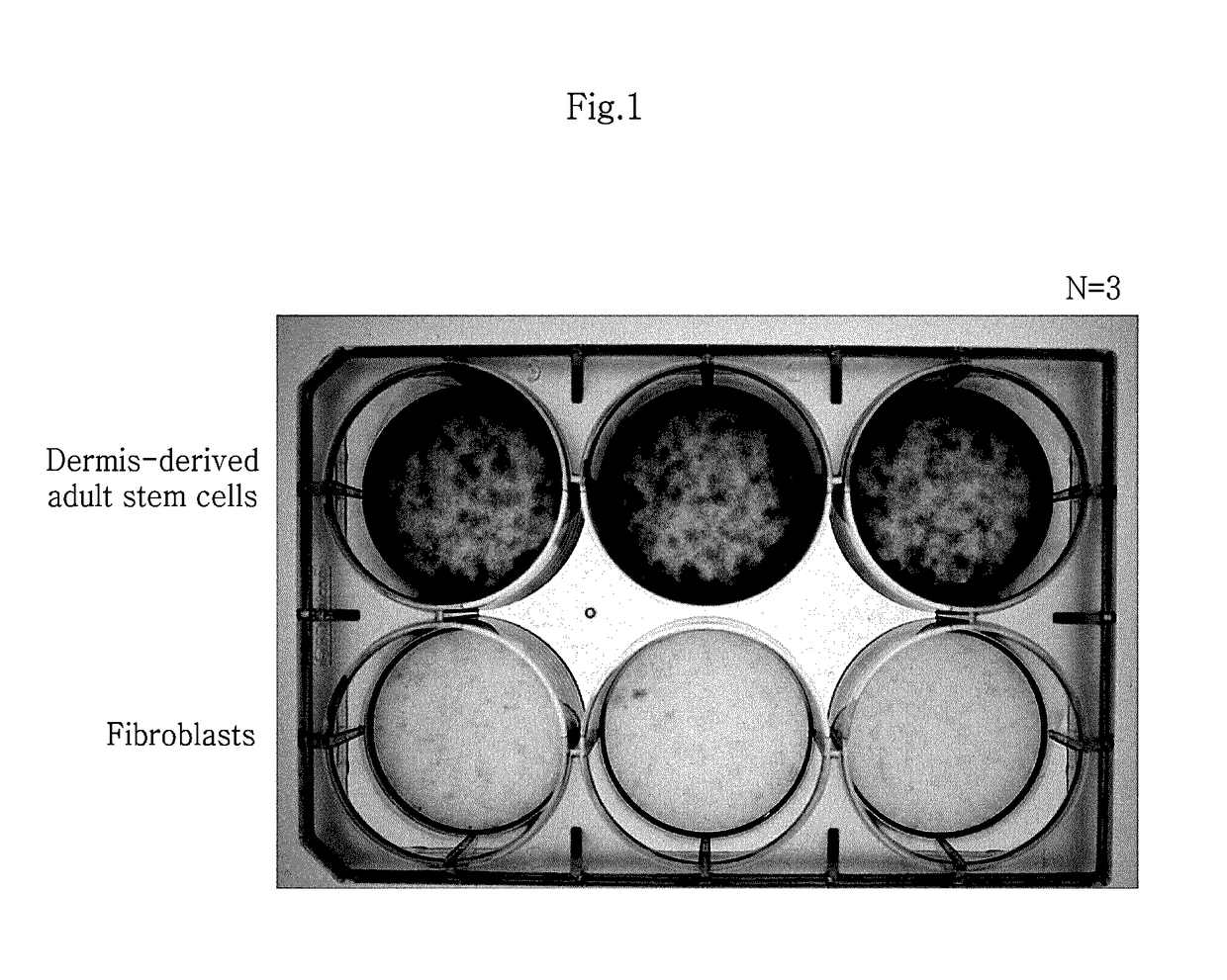 Adult stem cells derived from human skin dermis