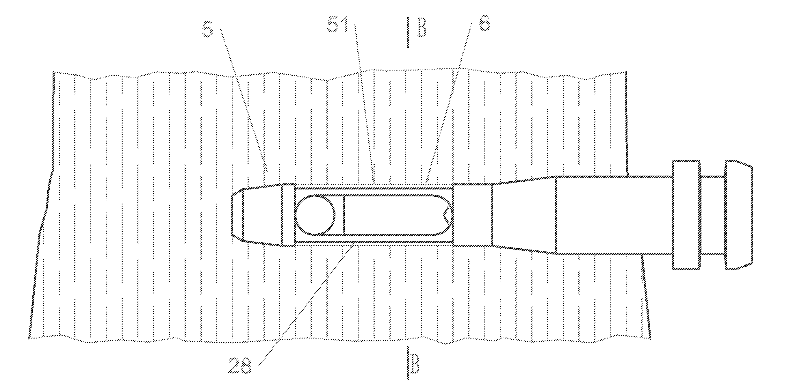 Trunk injection needle