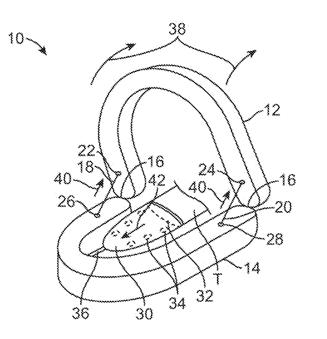 Mandibular advancement appliance