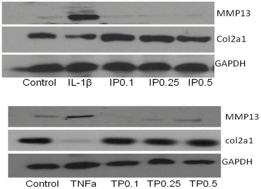 Application of compound in preparation of osteoarthritis therapeutic drug