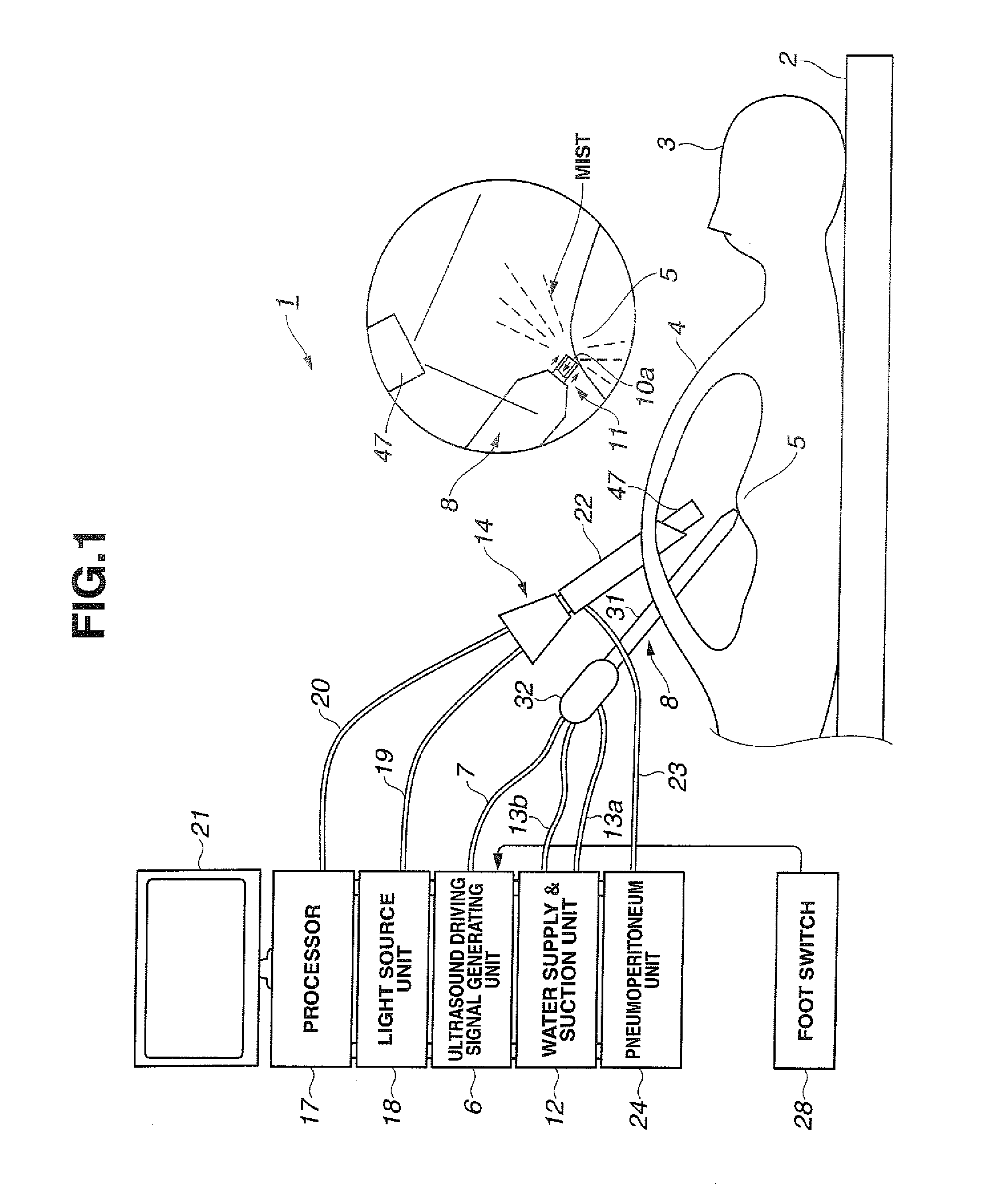 Ultrasound treatment system and method of actuating the ultrasound treatment system