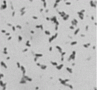 Microbacterium capable of completely degrading zearalenone and application thereof