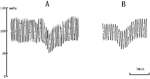 Device of extracorporally imitating blood pressure fluctuation rising and application method and use