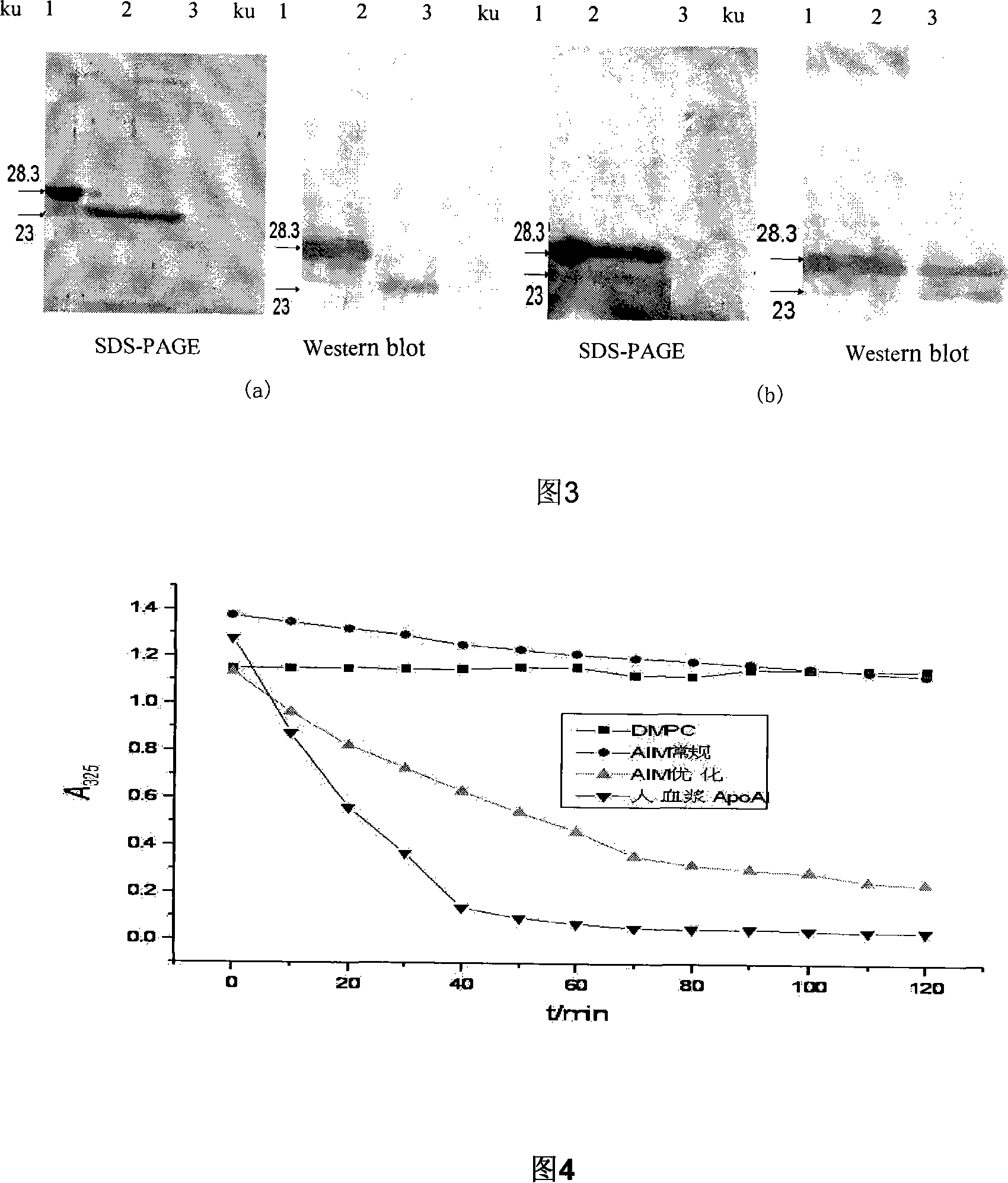 Expression method for recombination human apolipoprotein AI Milano variant in pichia pastoris