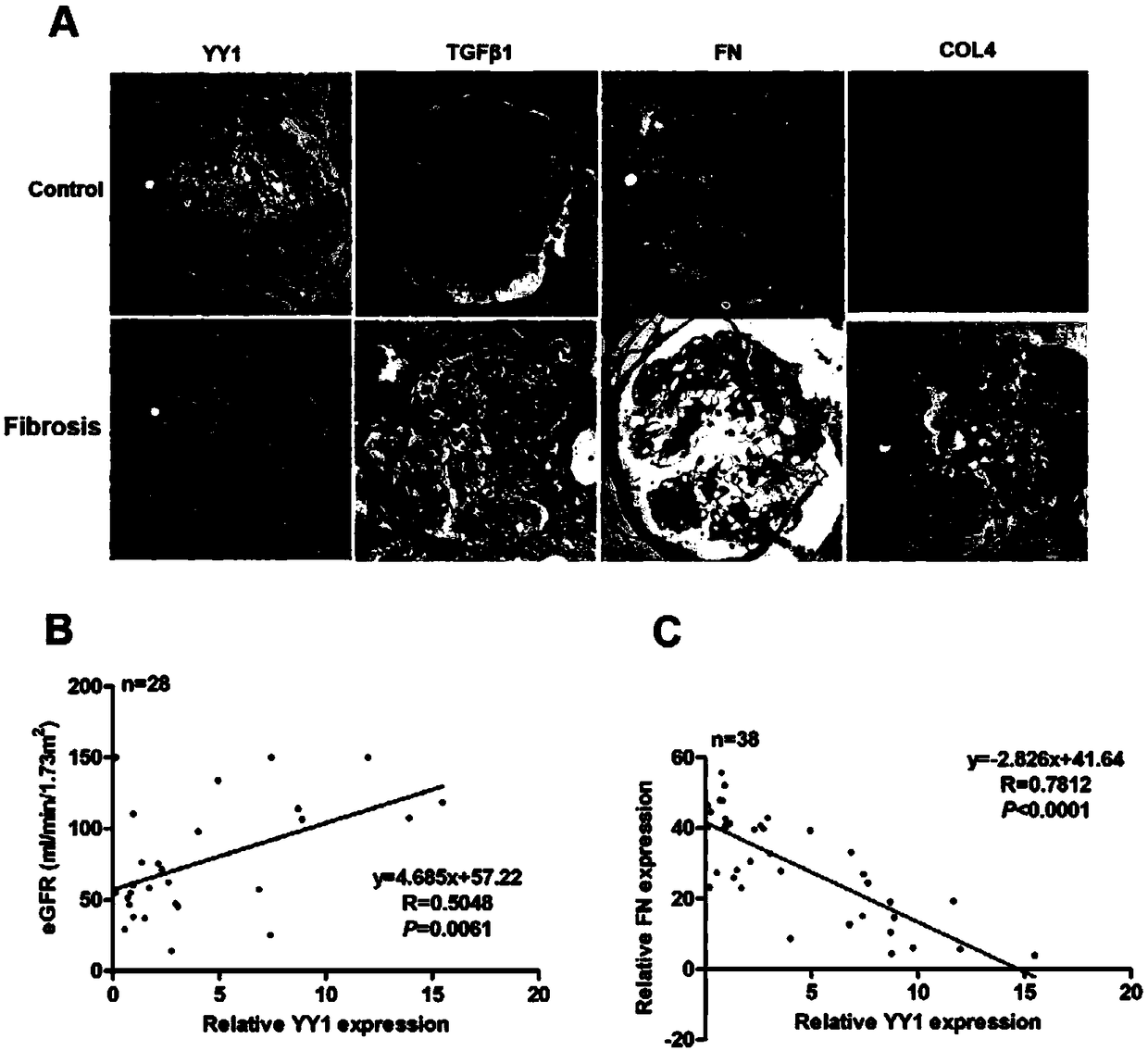 Recombinant virus and application thereof in preparation of medicine for preventing or treating renal fibrosis