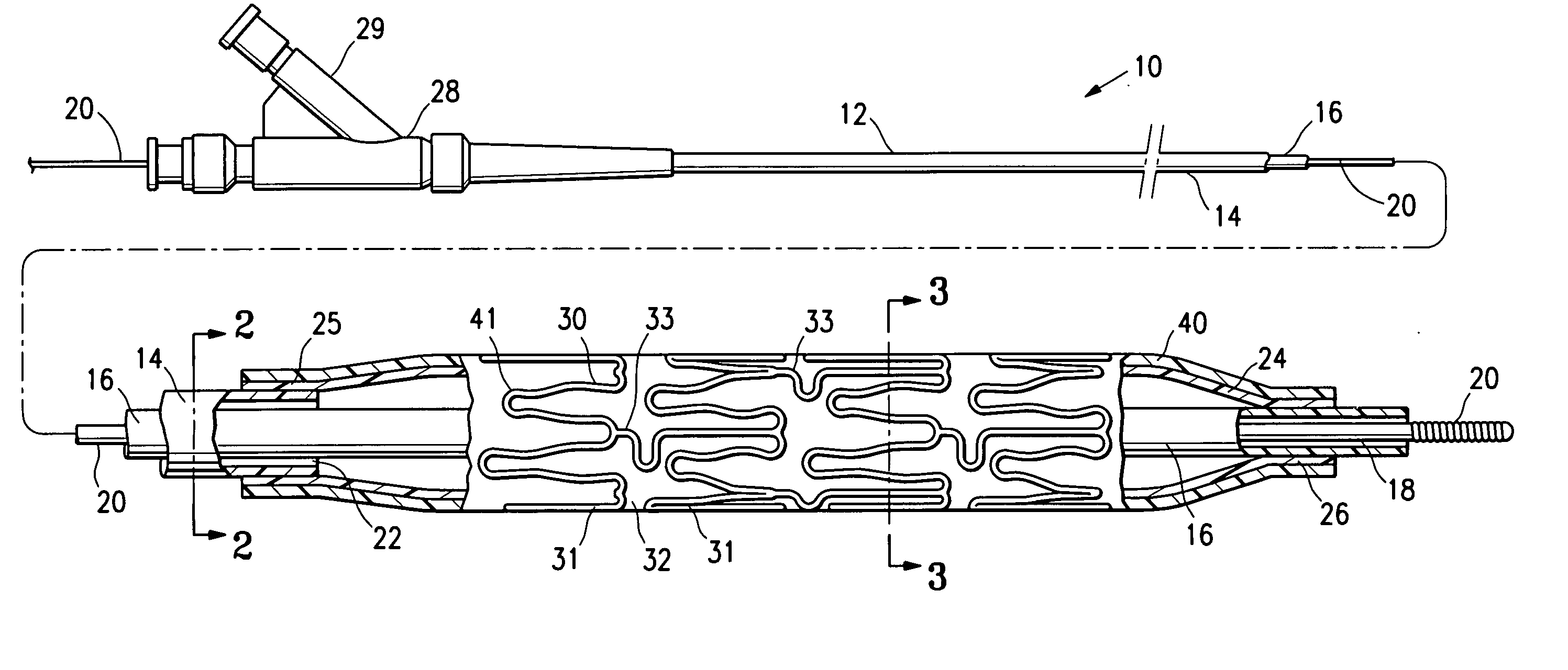 Stent delivery balloon catheter having improved stent retention